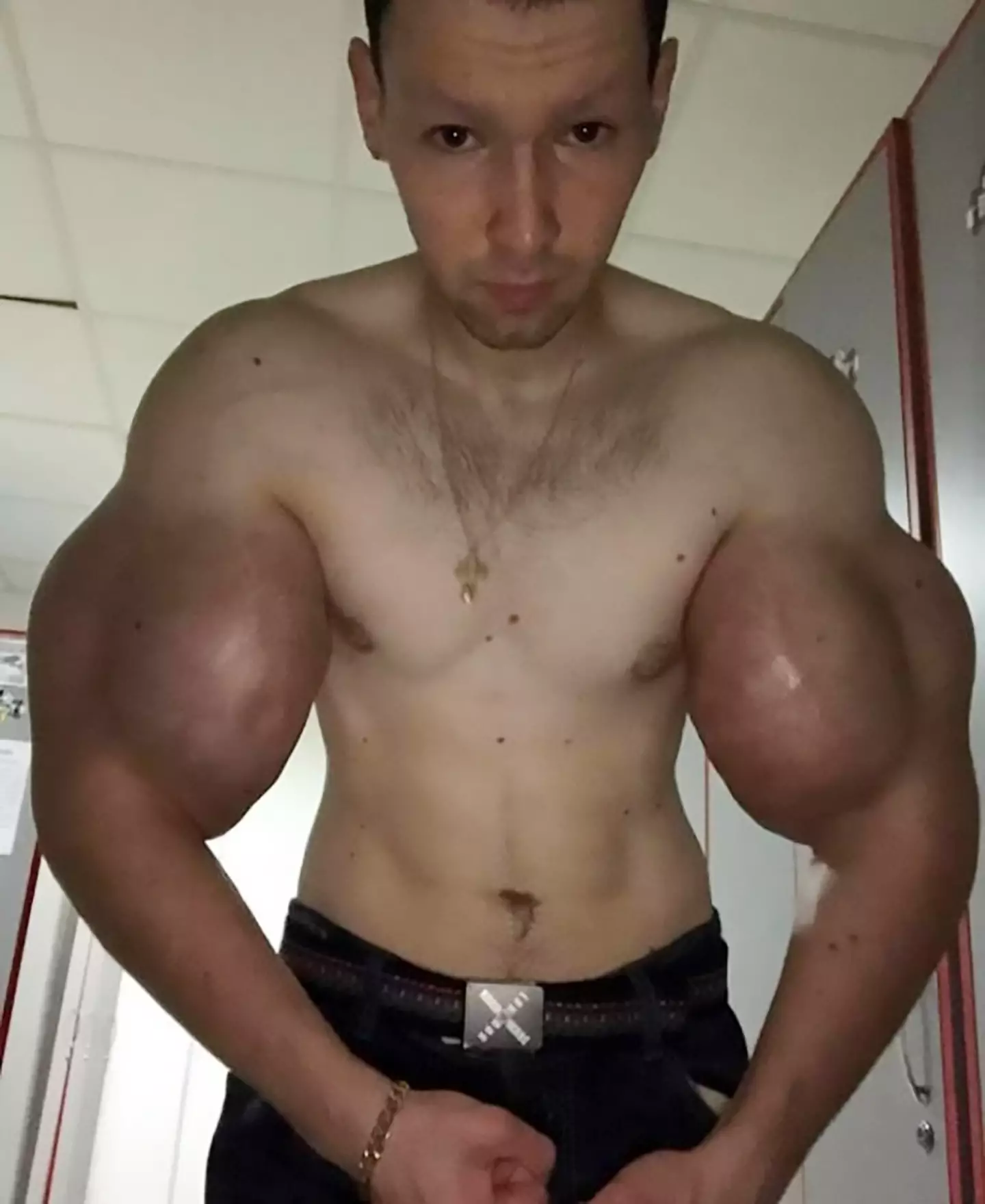 He inflated his arms, which has caused him all sorts of health problems (@ruki_bazuki_official/NewsX)