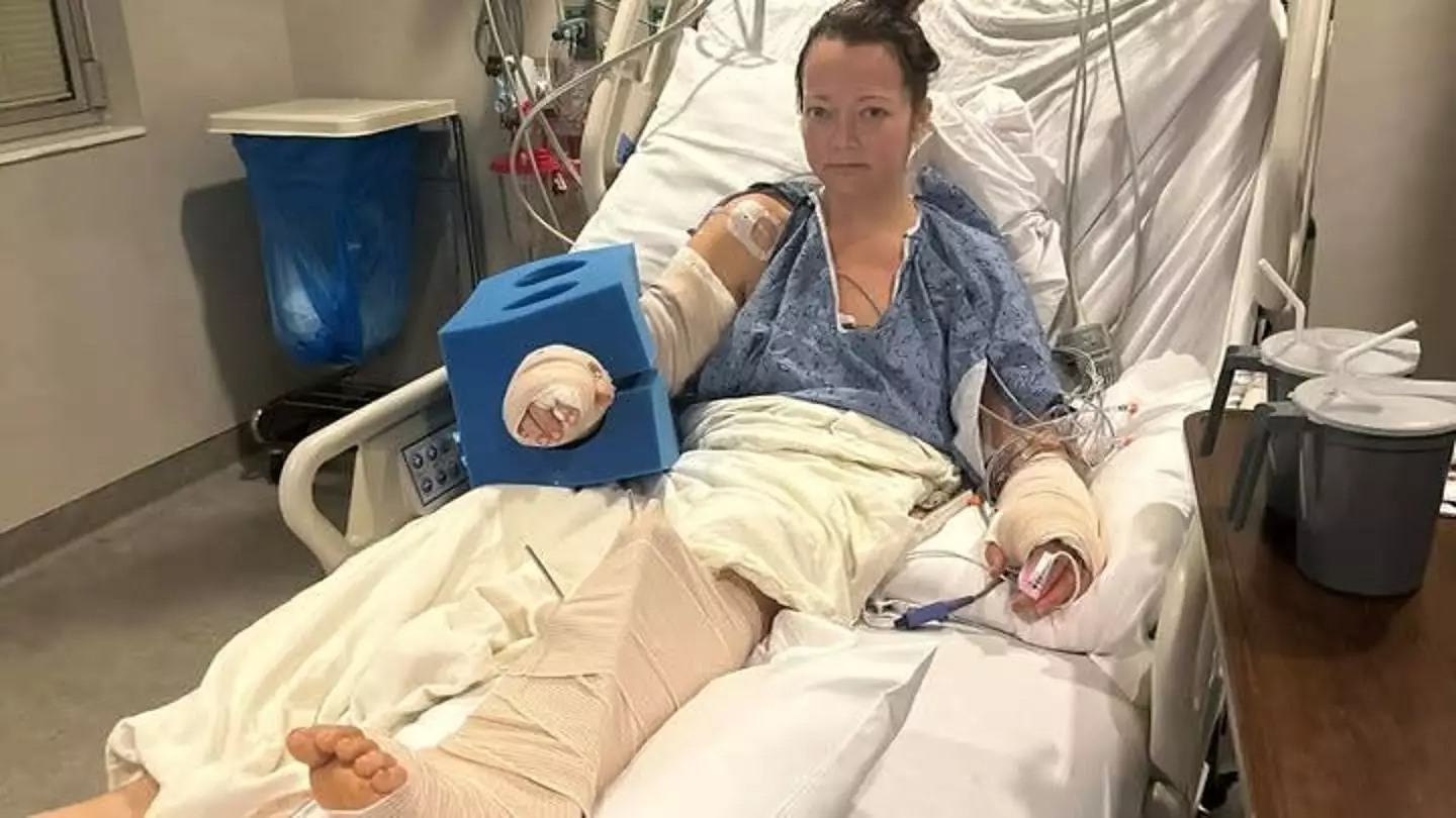 Amanda decided to have the leg amputated as it would have required a lot of time, pain and surgeries to attempt to save it (GoFundMe)