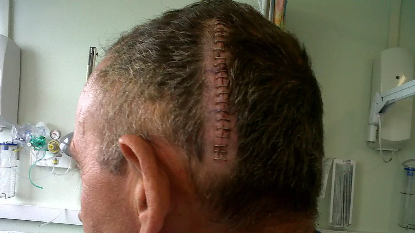 Dad diagnosed with brain cancer after symptoms were dismissed by doctor who accused him of 'faking it'