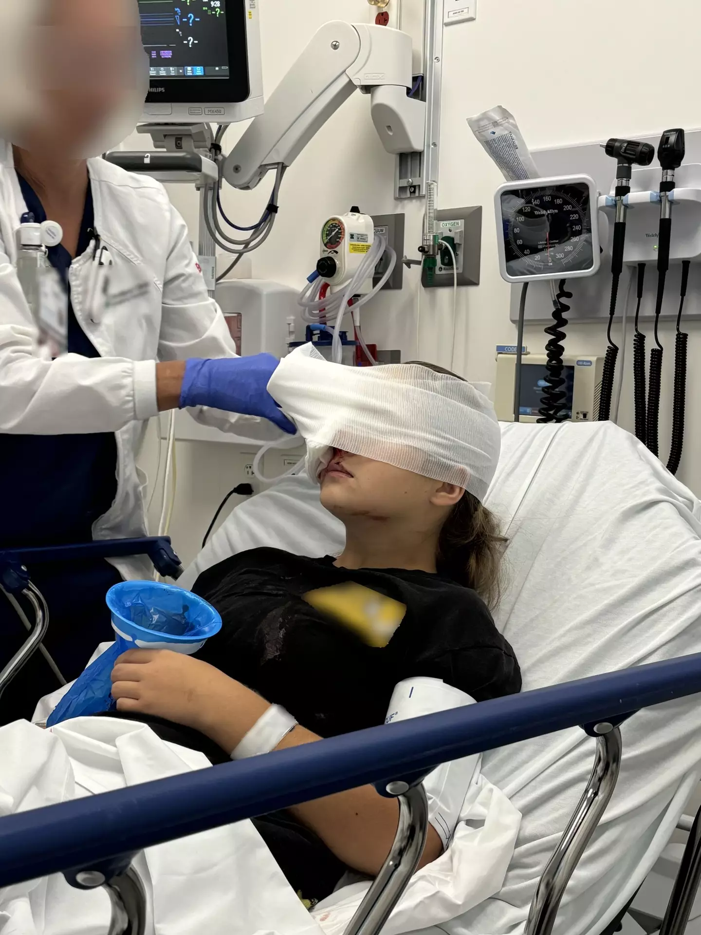 Kylie spent several 'excruciating' days in the hospital, and is now awaiting prosthetics for her right eye. (Kennedy News and Media)