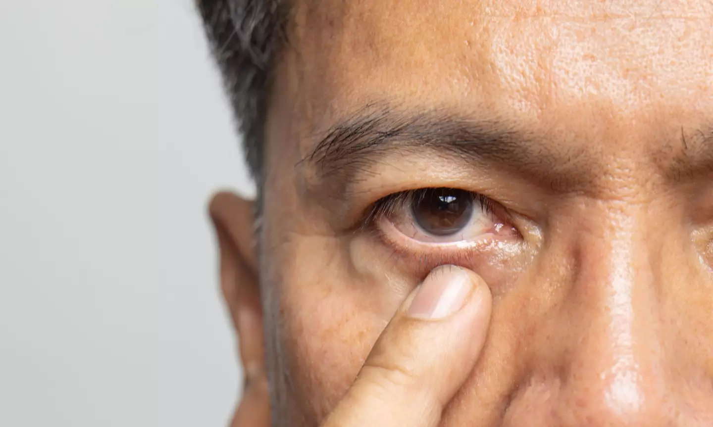 A twitching eye is pretty annoying, right? (Getty Stock Photo)