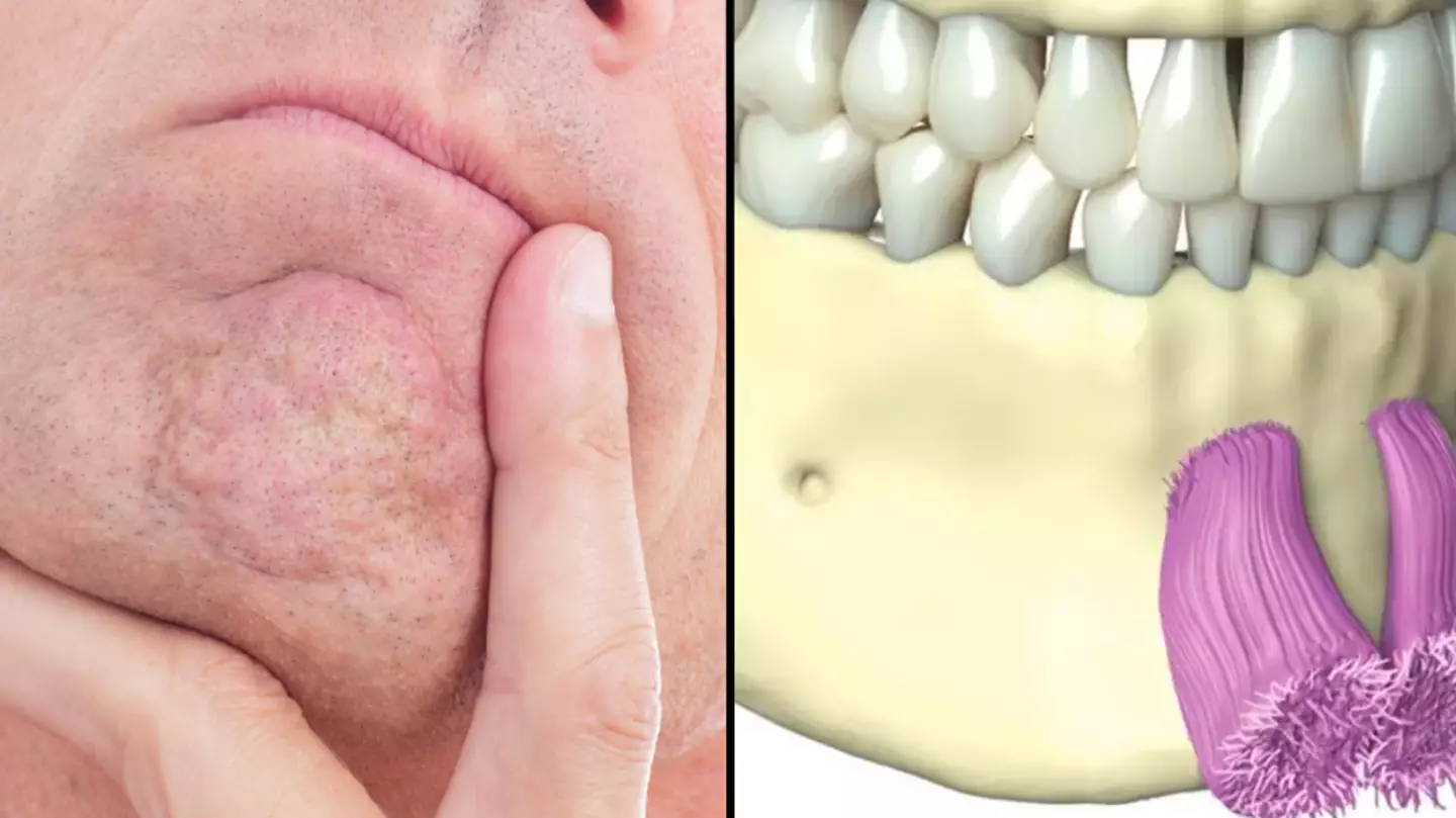 People left feeling sick after finding out what chin dimples are