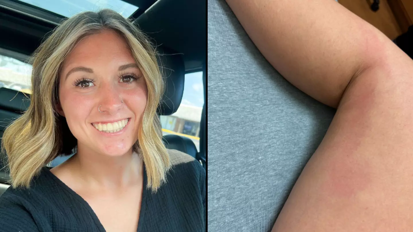 Mum issues advice after spotting red mark on leg that turned out to be potentially deadly 60cm blood clot