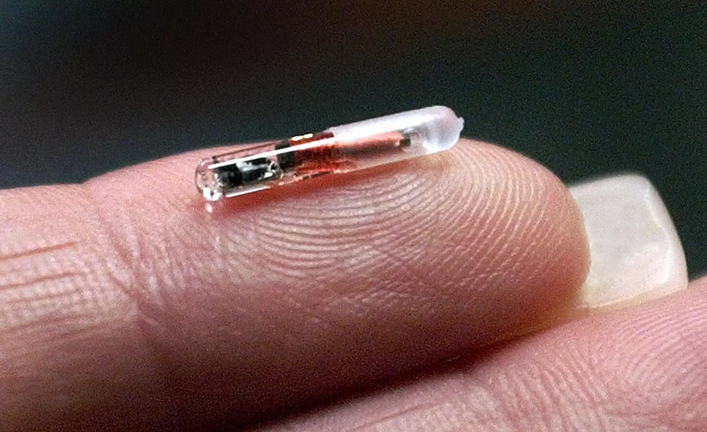 Do you want an implant? (RHONA WISE / Stringer / Getty)