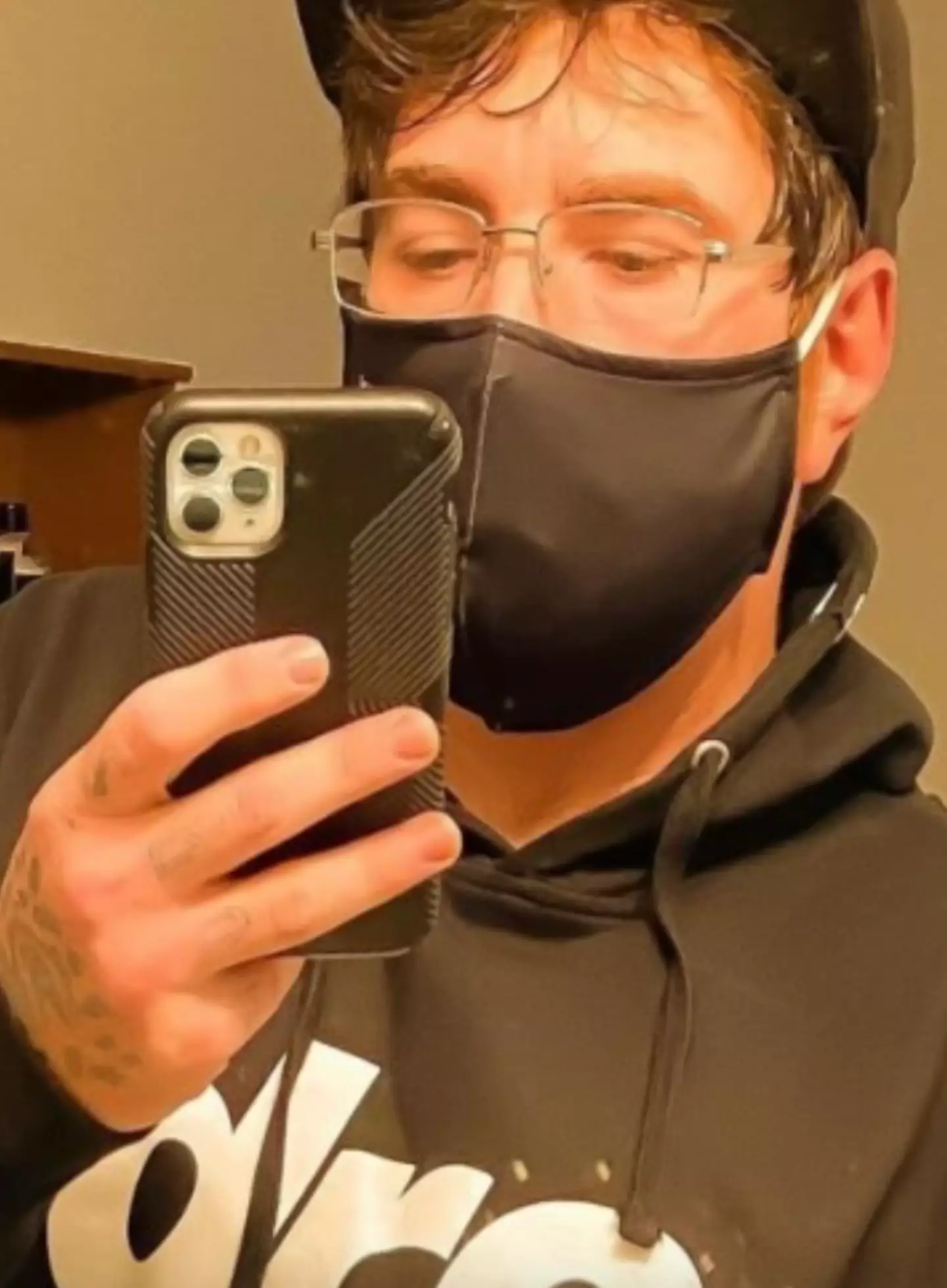 Michael has revealed the impact that a micropenis has on his everyday life. (Instagram/whutzhisphaze)