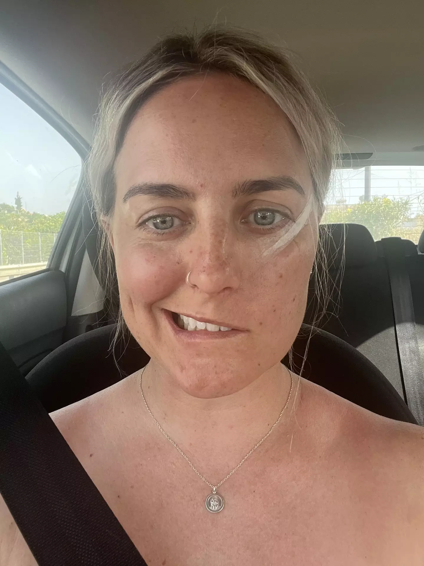 Emma was told that the condition was, in part, caused by stress (Kennedy News and Media)
