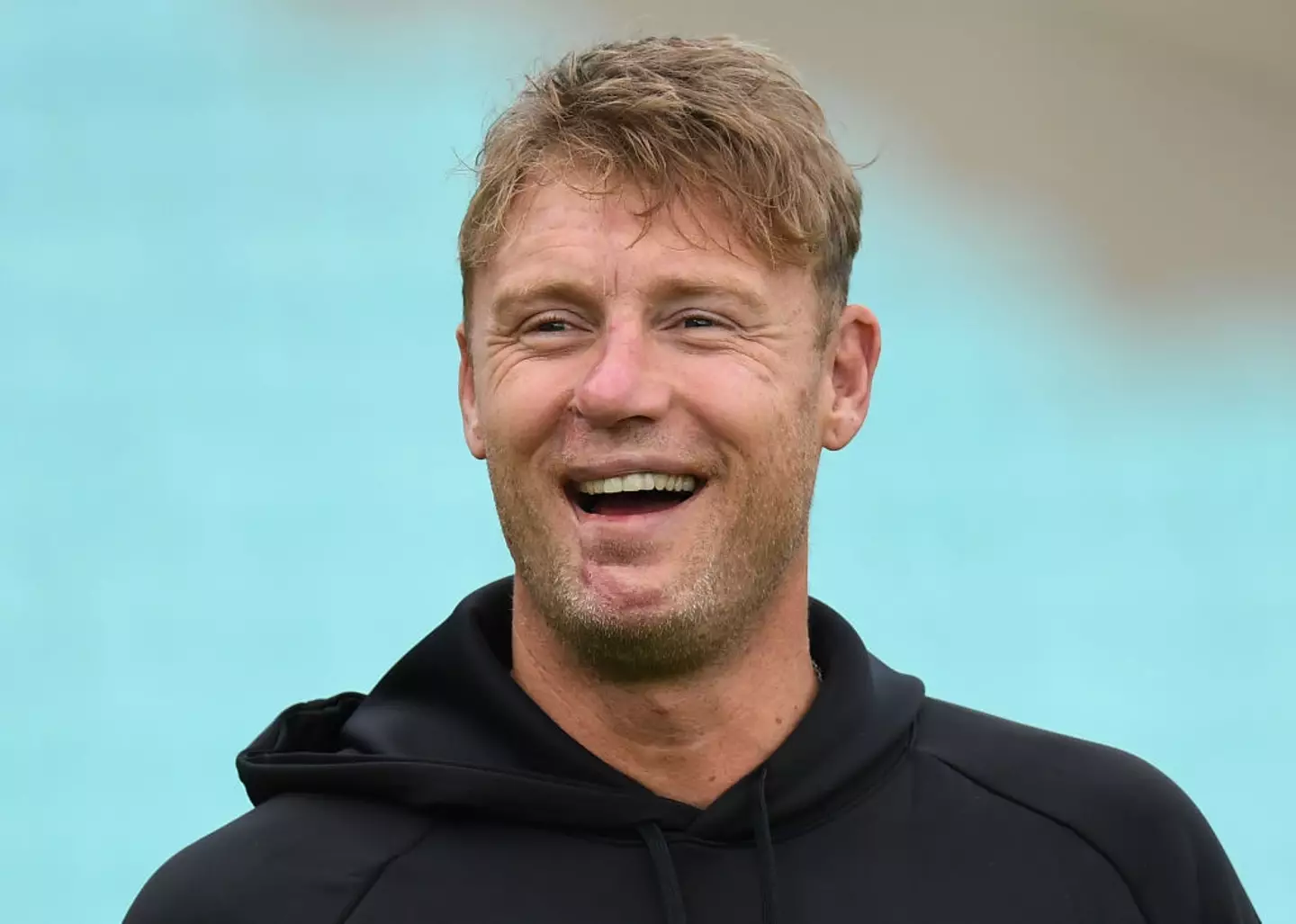 Flintoff with visual face scars after the incident on Top Gear (Philip Brown/Getty Images)