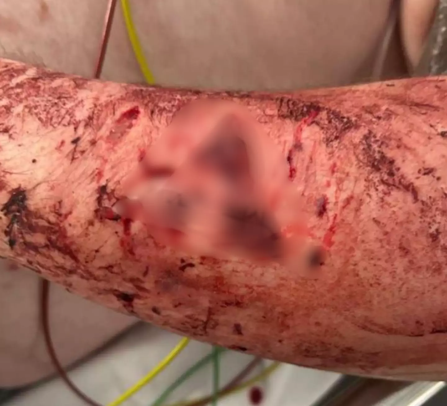 Ending up in hospital, he's been credited with saving their lives (JustGiving)