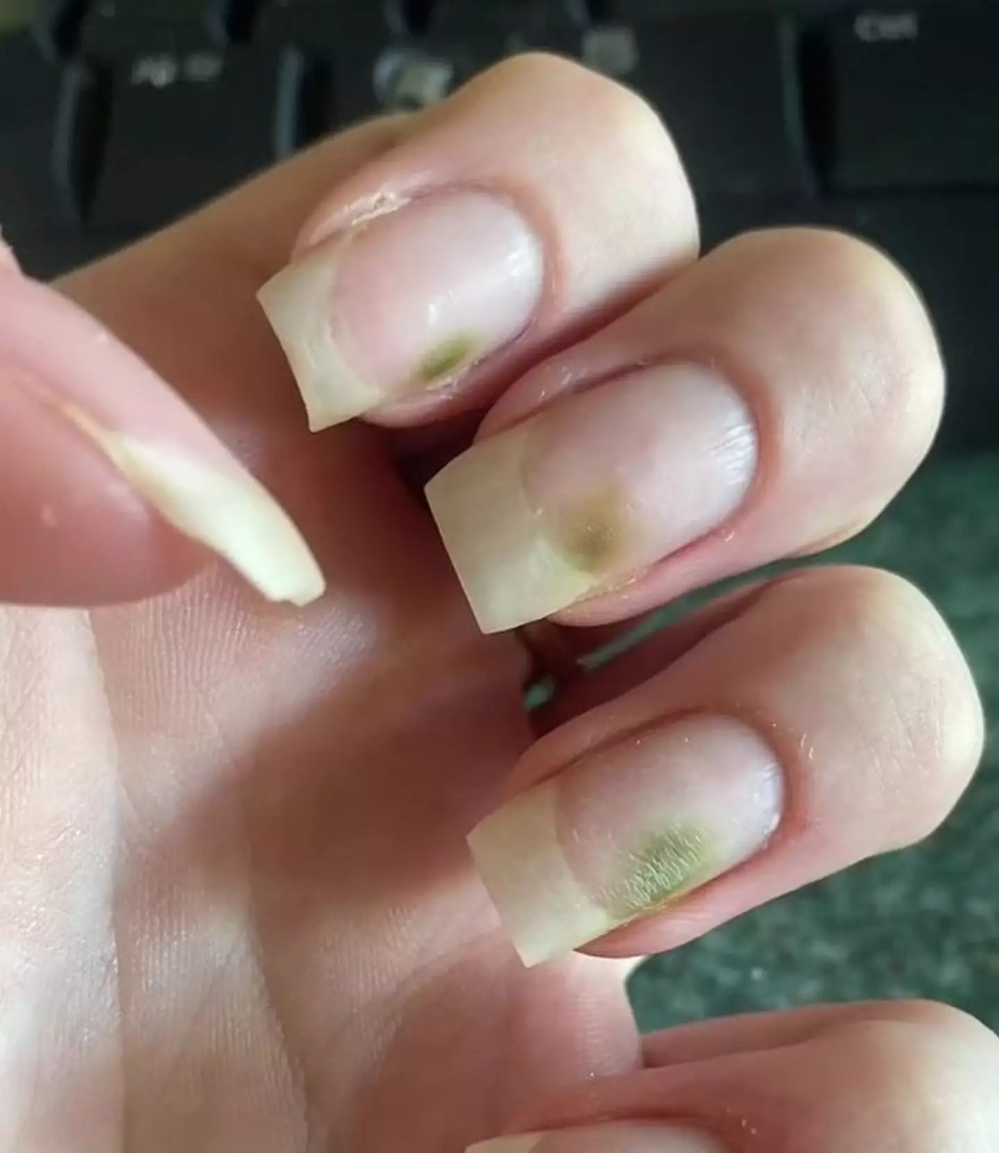 Phoebe's nails turned green.