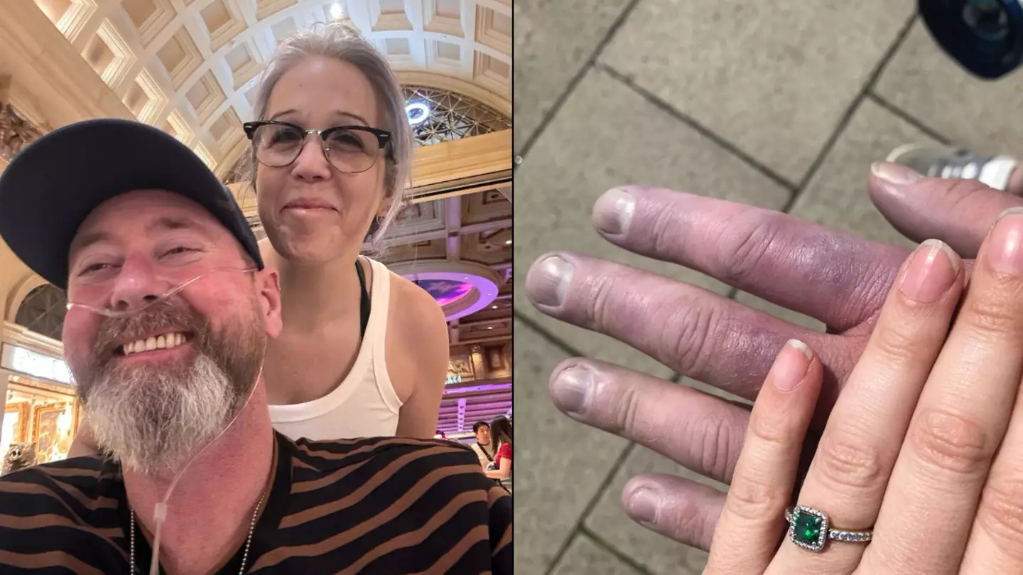 Man shares warning signs after being given two years to live when cold hands turned out to be deadly condition