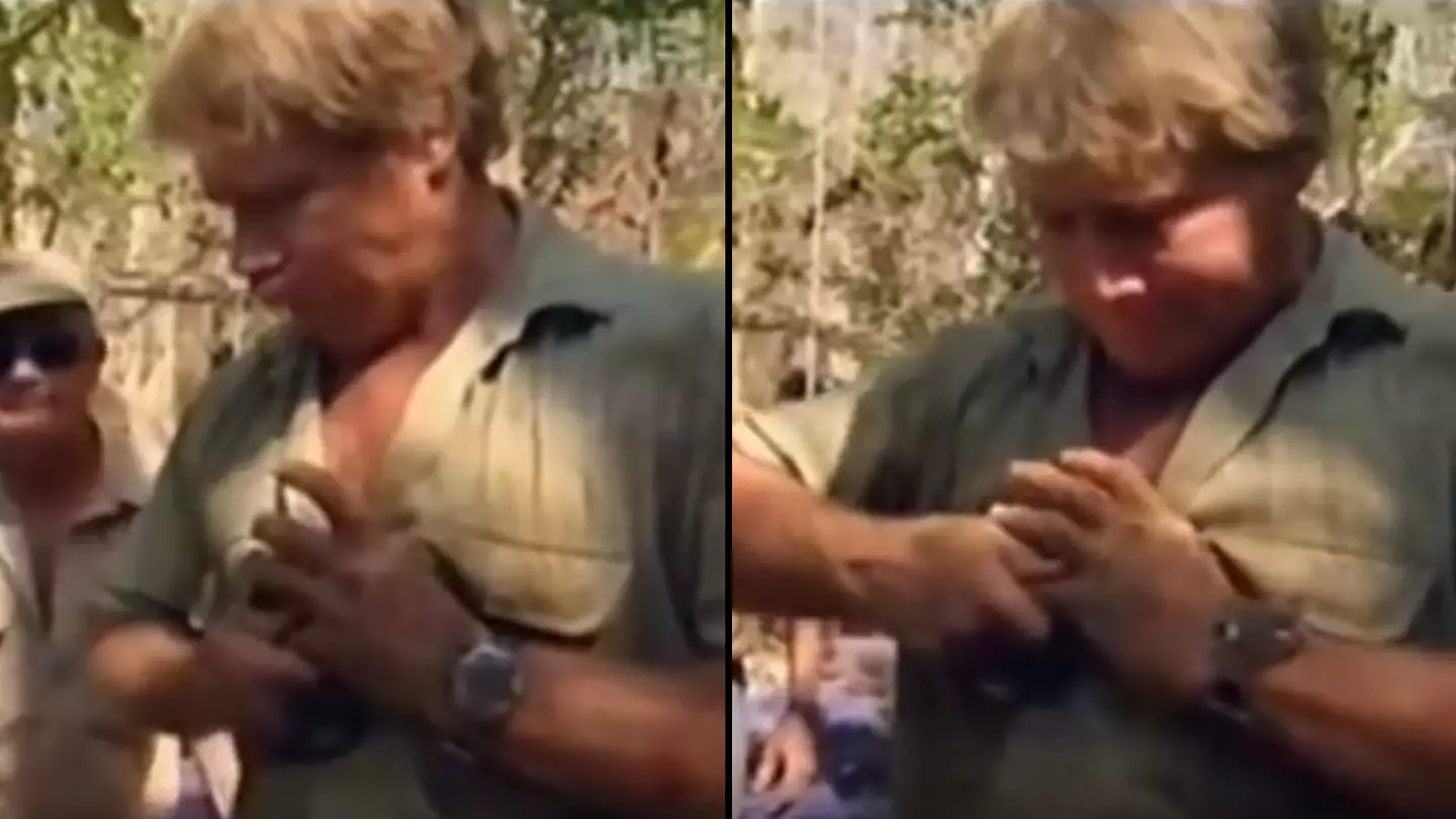 Steve Irwin 'fixing' broken finger shows the man was just built different