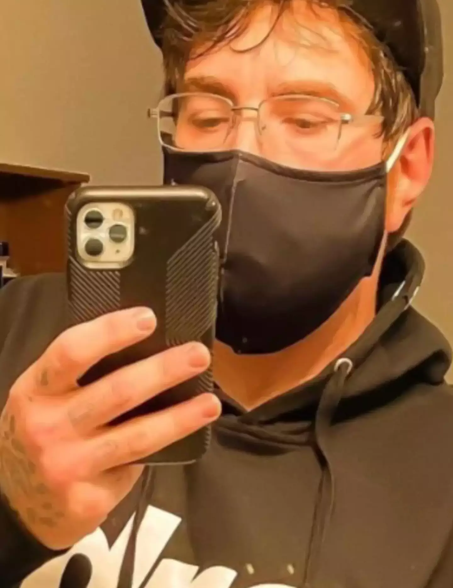 Michael has been open about his 'micropenis' condition (Instagram/whutzhisphaze)