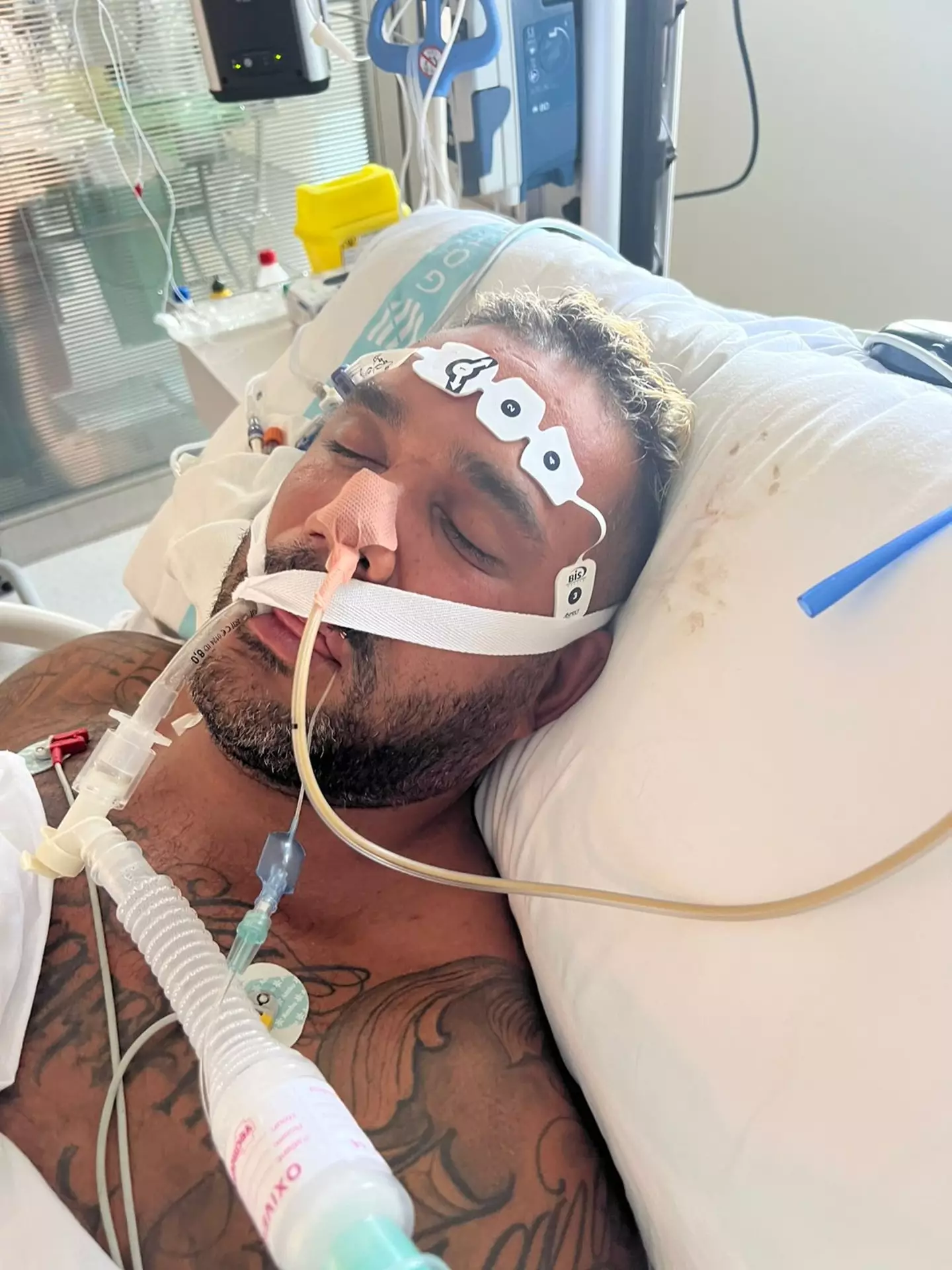 The father-of-two was placed in an induced coma and died five days after the incident.