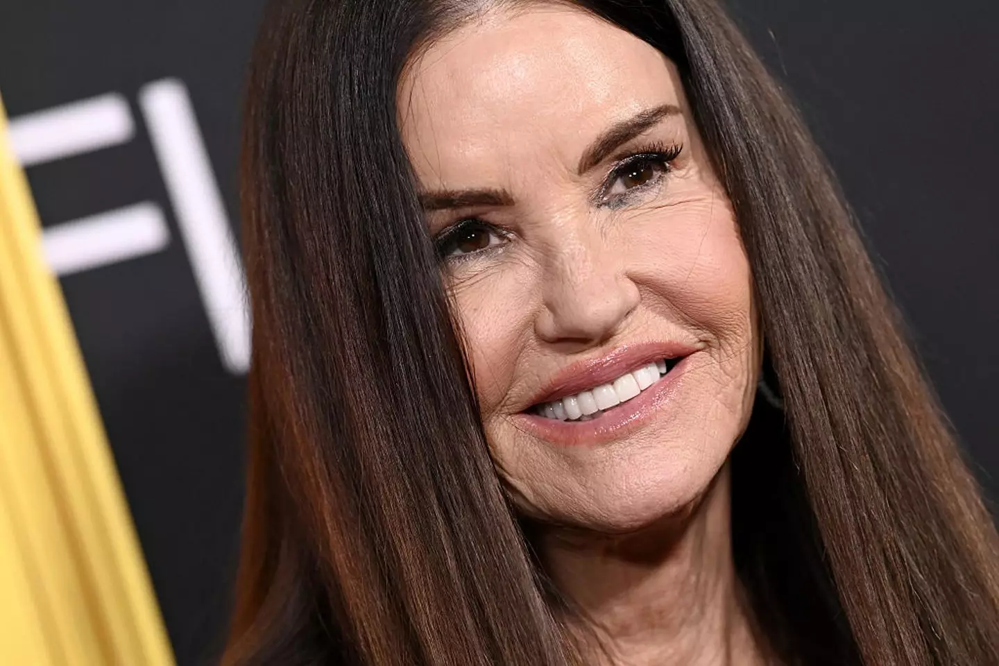 Dickinson believes it has cost her contracts with modelling agencies (Axelle/Bauer-Griffin/FilmMagic)