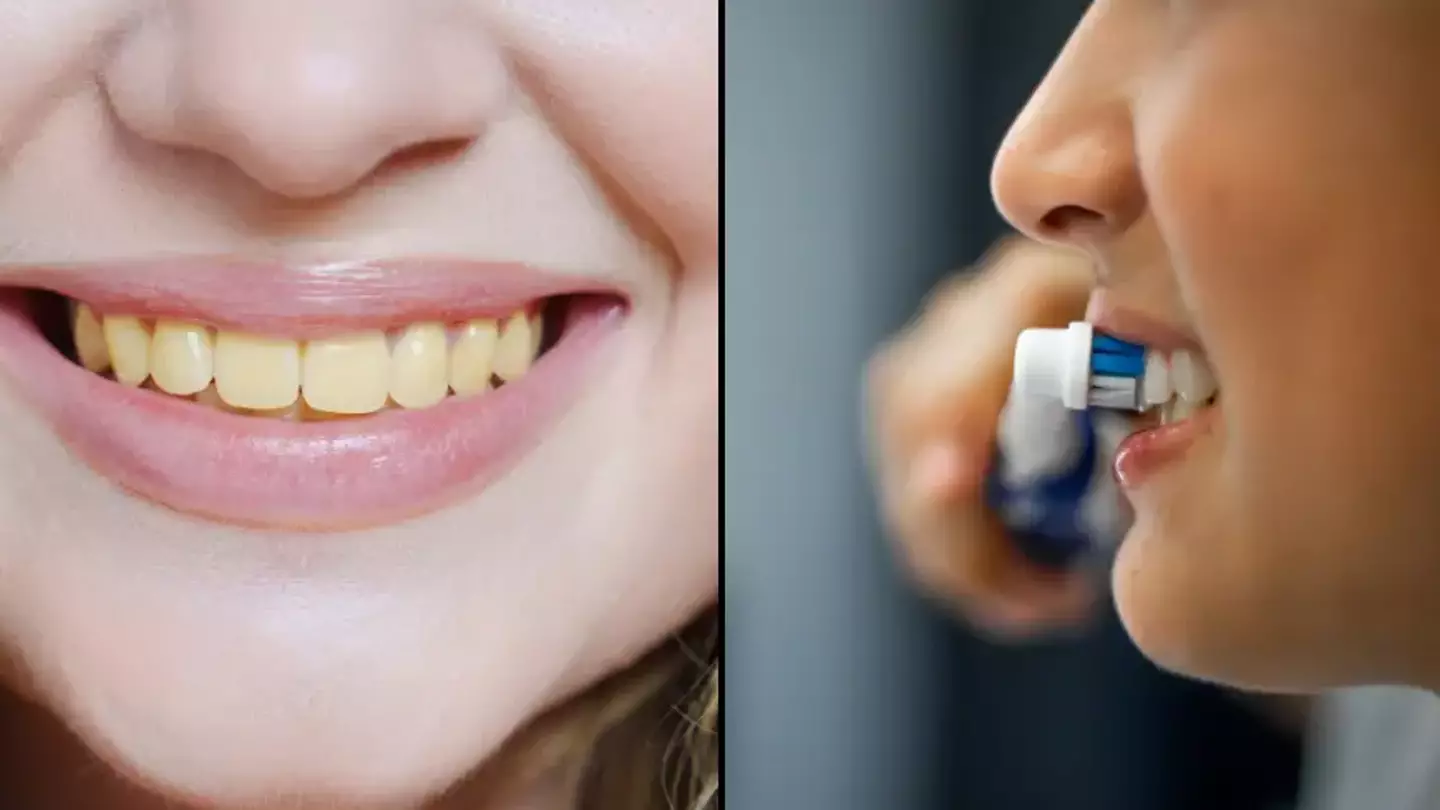 Dentist warns people about the one main mistake they are making that makes their teeth go yellow