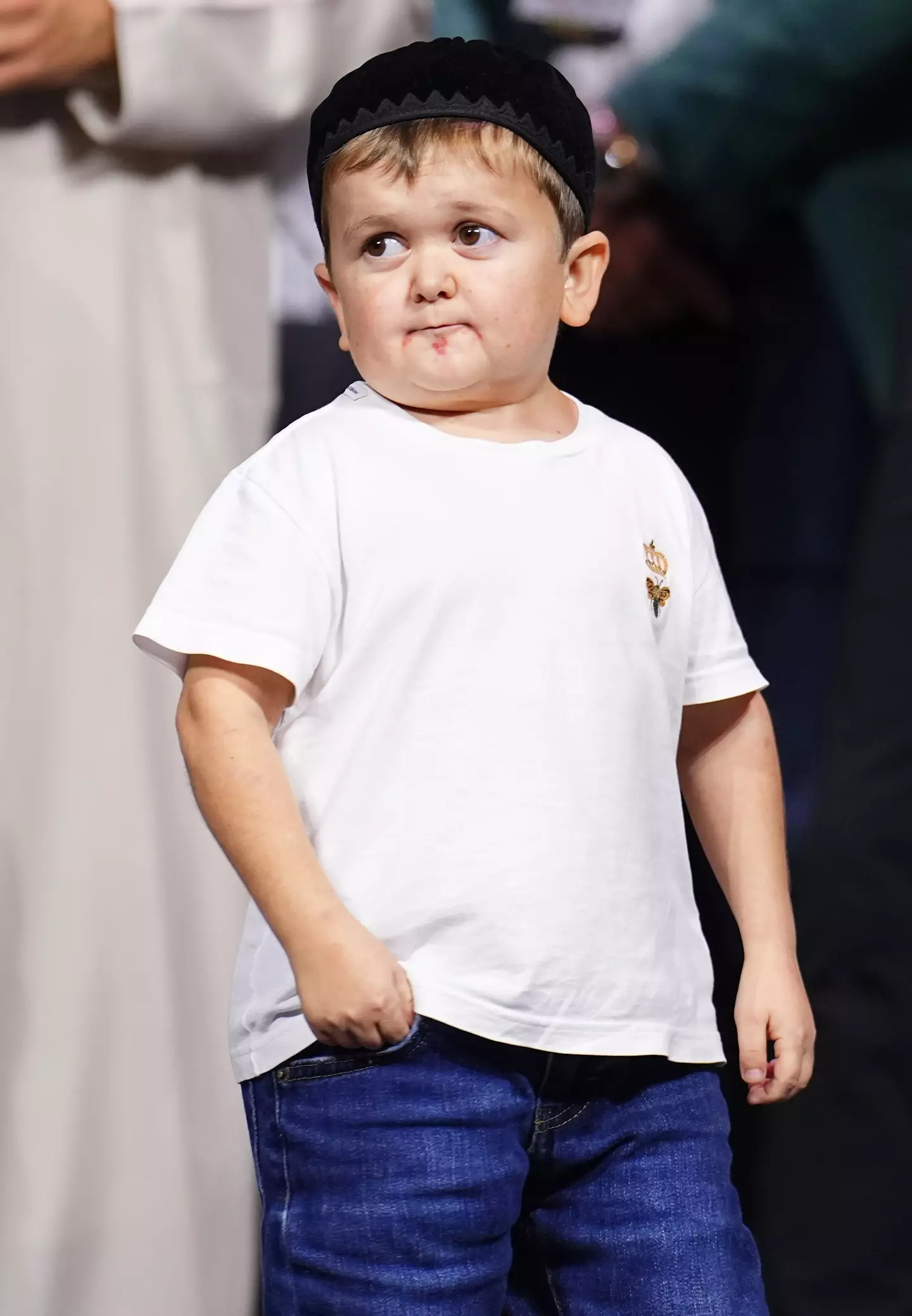Hasbulla hasn't spoken about it much himself, but doctors say he is likely to have Growth Hormone Deficiency (Chris Unger/Zuffa LLC / Getty Images)