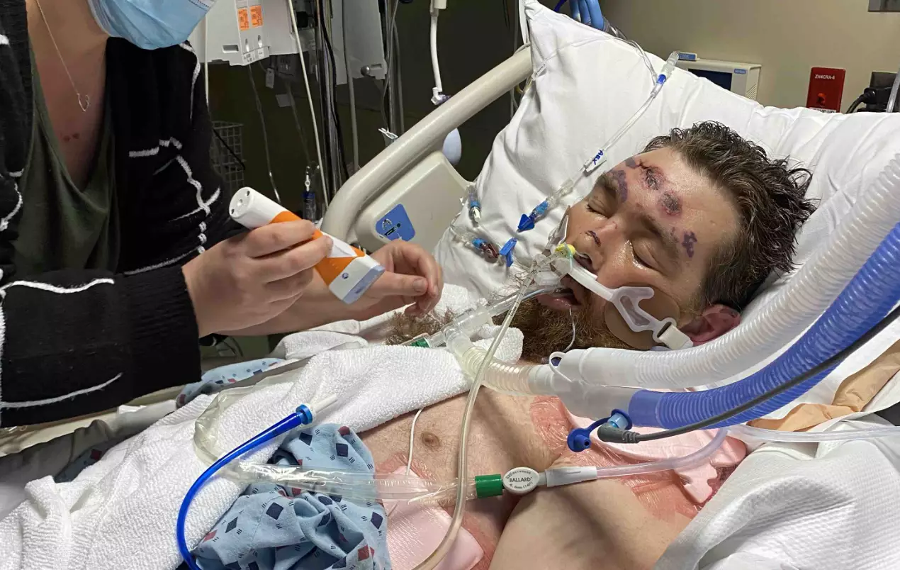 Doctors have warned people to be wary of 'less-known' signs of sepsis, which can be dismissed for flu-like symptoms (GoFundMe)