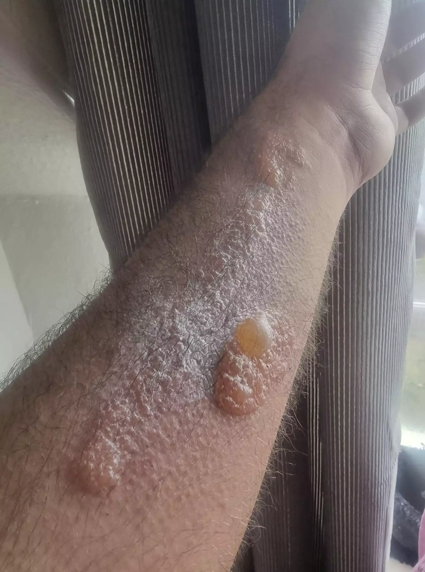 He only left the product on for five minutes.