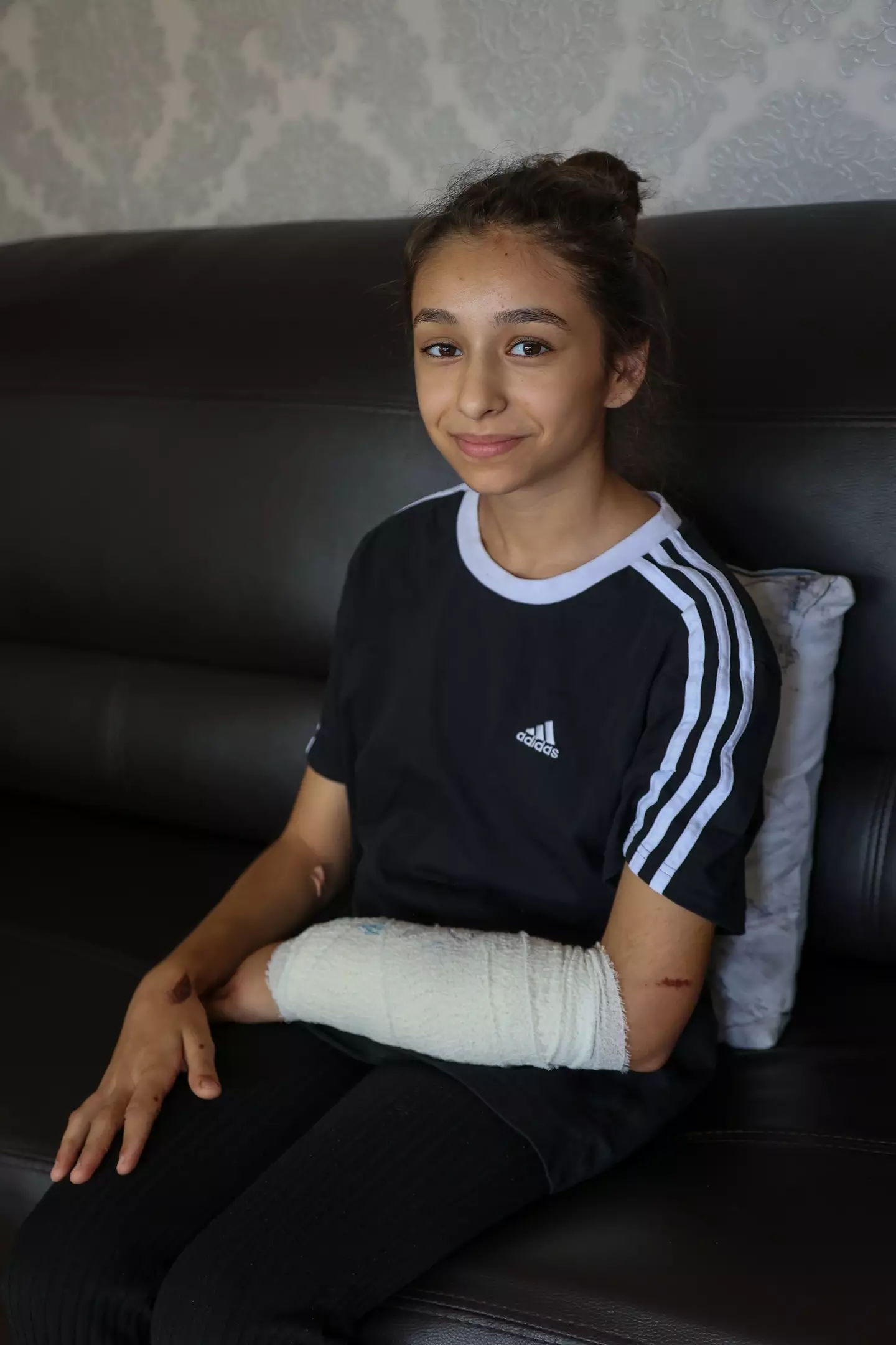 Ana Paun, 11, was left with injuries to her arm from the dog attack.