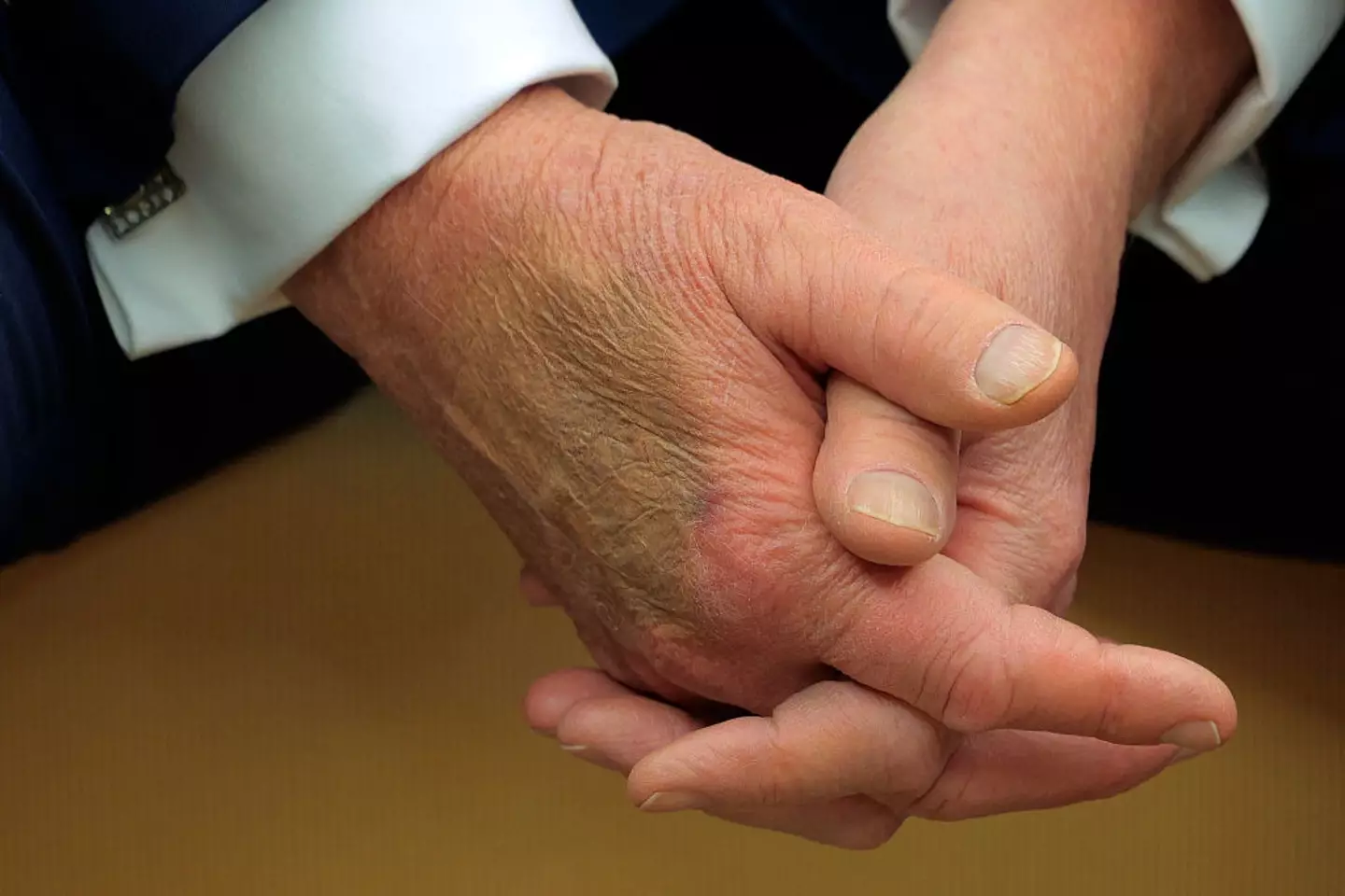 The orange foundation was fighting hard against this one (Chip Somodevilla/Getty Images)