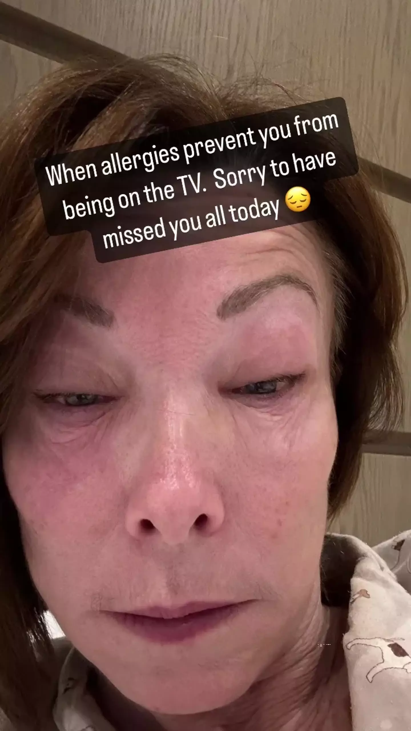 Burley shared a shocking selfie showing the result of her allergic reaction.