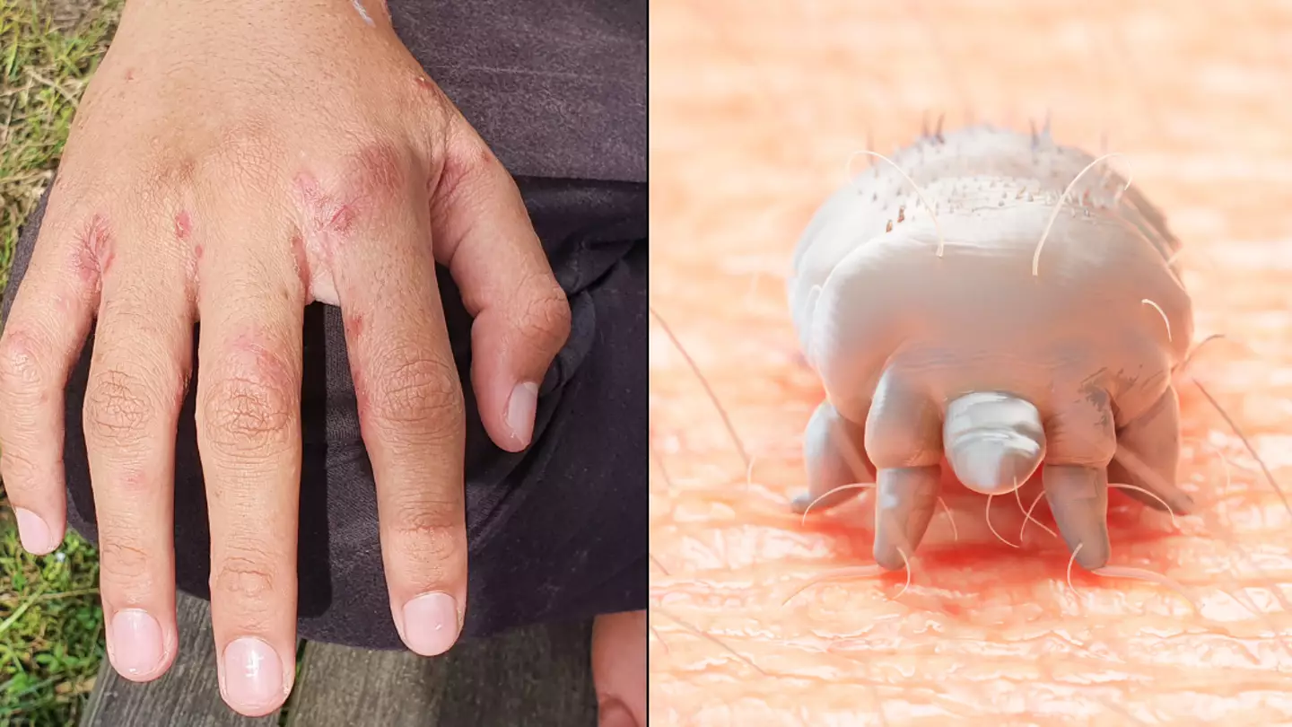 Experts explain who is most likely to get 'tiny red dots' you shouldn't ignore on skin as infections spike in UK