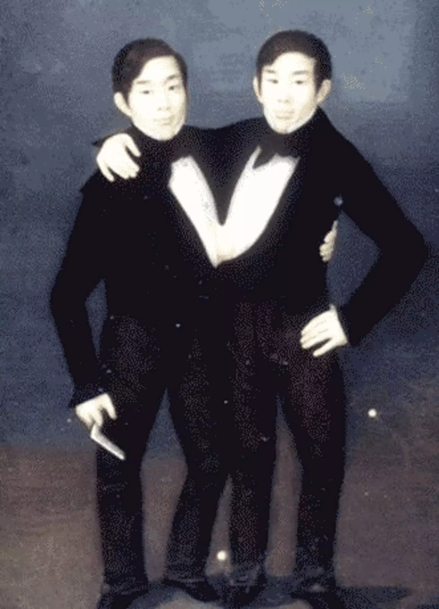 The infamous Siamese twins, Chang and Eng Bunker. (CatherineMunro/Wikimedia Commons/Public Domain)