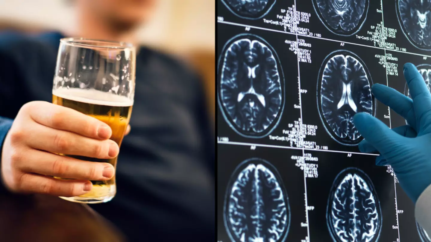 Doctor shares exact age you should stop drinking if you want to prevent dementia
