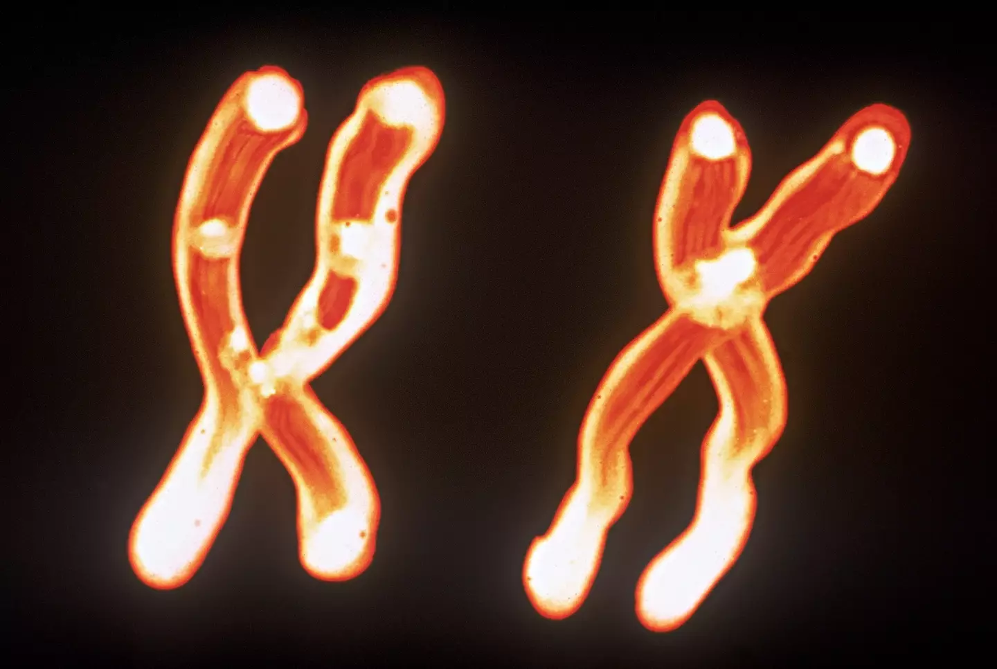 An XY chromosome (Getty Stock Images)