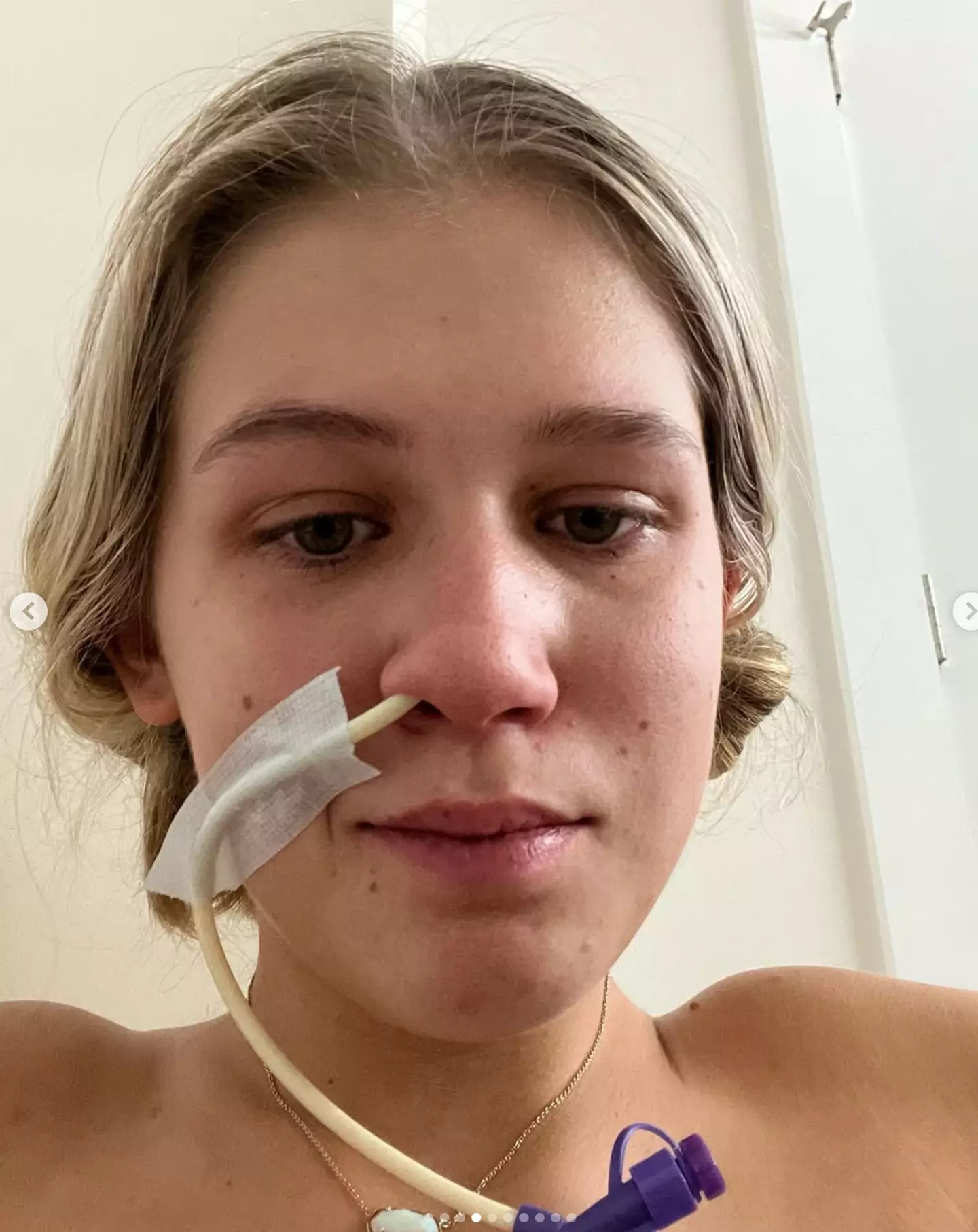 Sydni was hospitalised after being unable to eat (Instagram/sydnicollinsss)