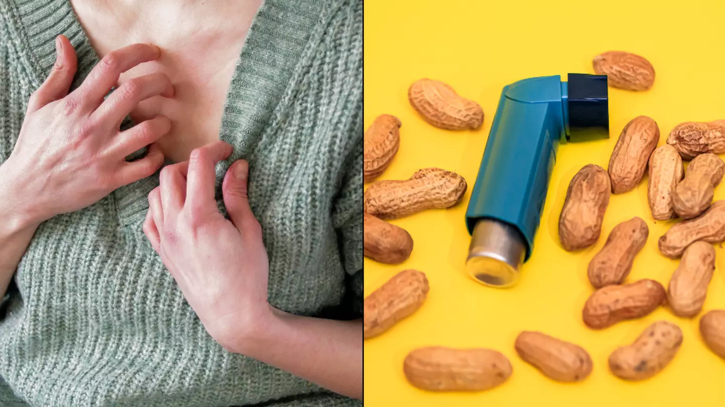 Common drug could help stop food allergies from killing you