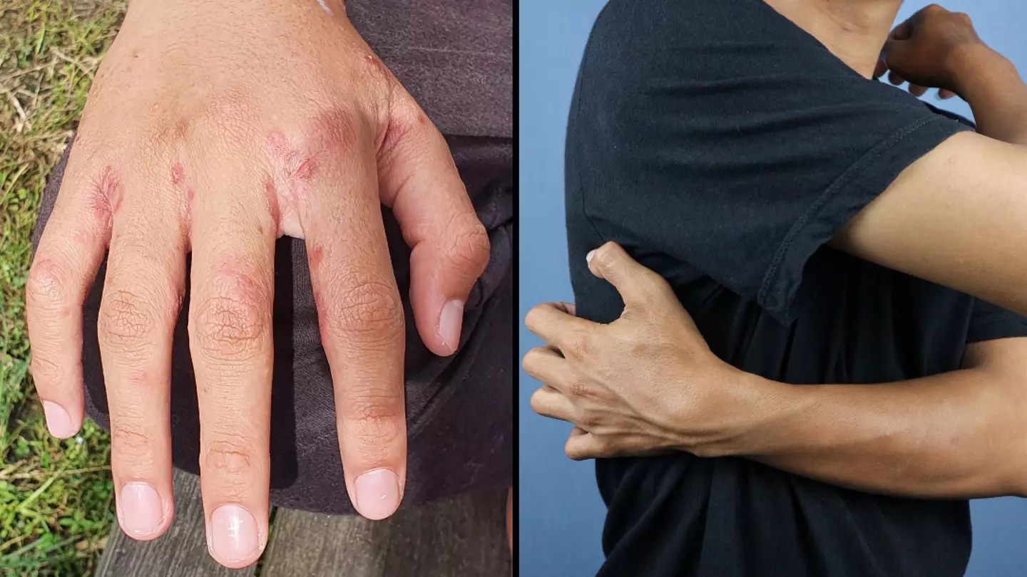 Doctors warn Brits not to ignore ‘tiny red dots’ on their skin as infections spike in UK