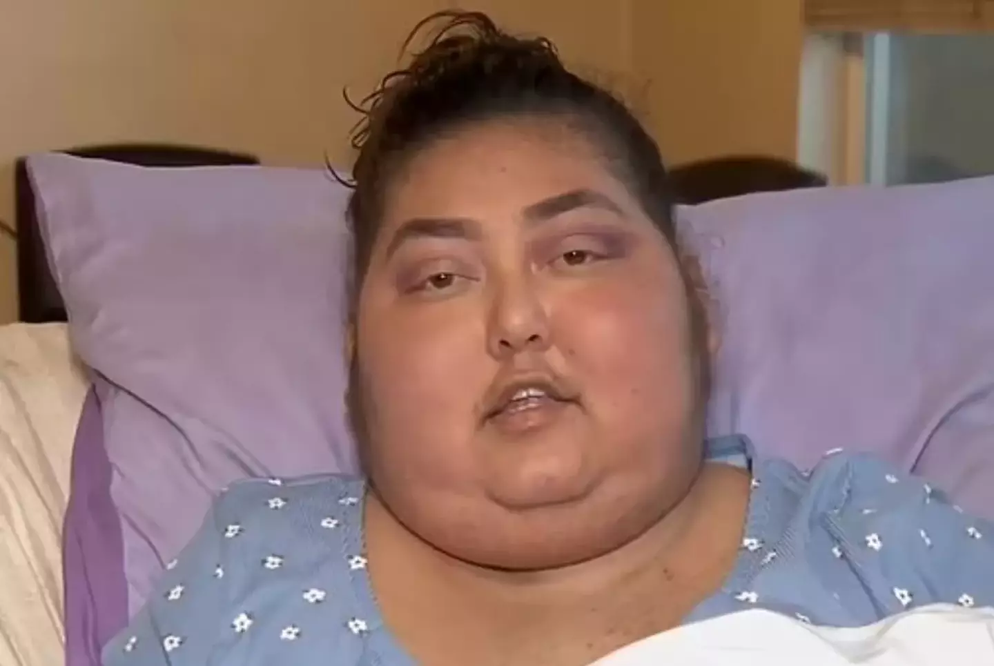 Erika was diagnosed with Cushing's Syndrome. (ABC)