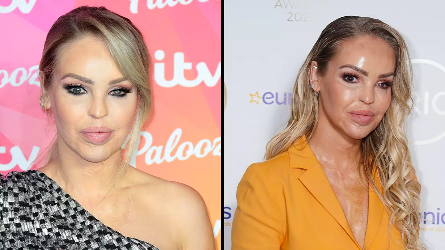 Police hunting man who threw acid over Katie Piper after going on the run