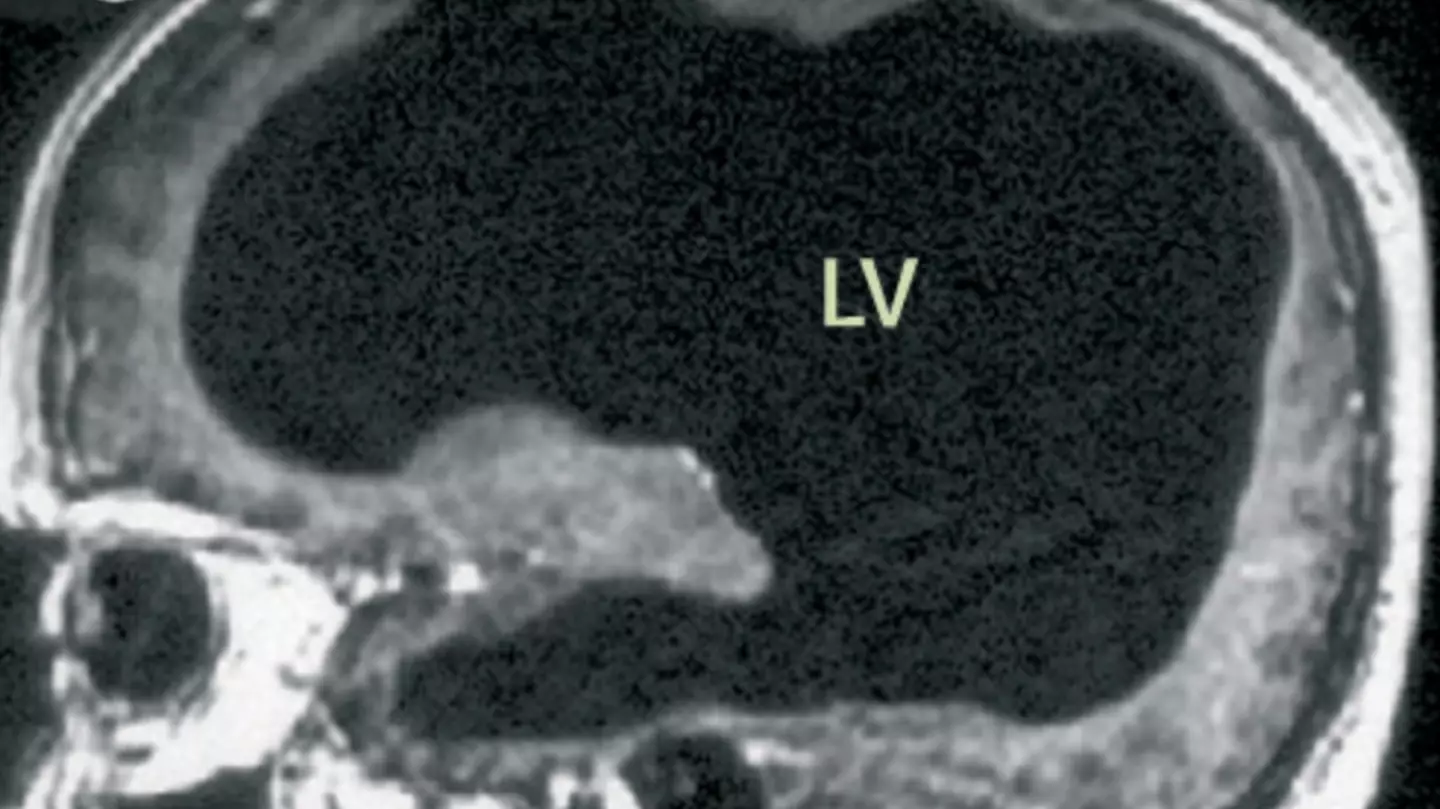 The Lancet