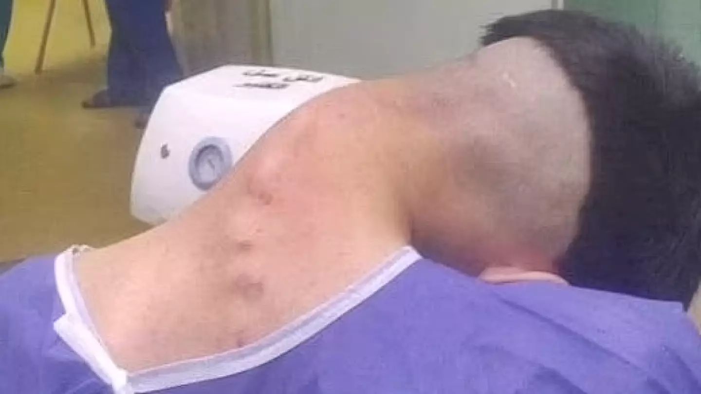 Neurosurgery data from Iran's Isfahan Medical University