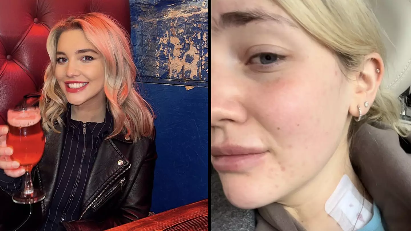 Graduate who experienced headaches after one glass of wine discovers they were sign of cancer