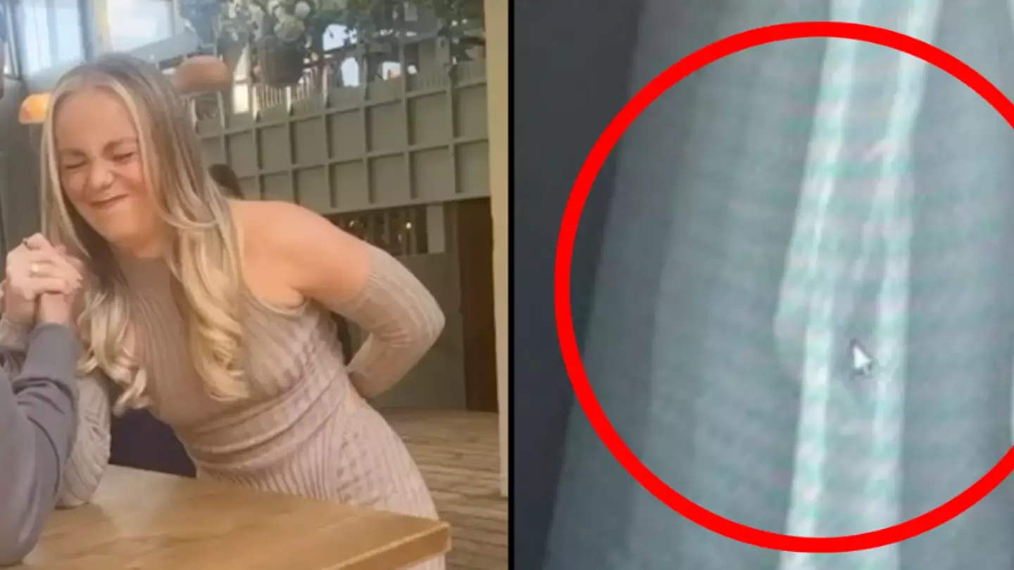 Horrifying moment woman's bone snaps during arm-wrestle with stranger