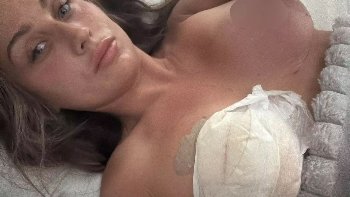 Mum-of-five's agony trying to save nipples and breast after Turkey boob job complications mean she can't leave the country