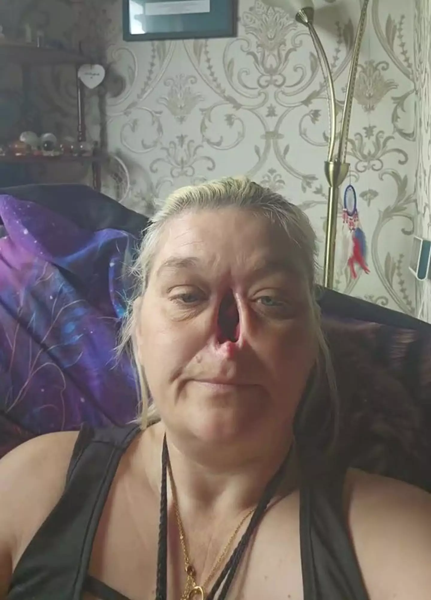 Ellen had initially put her health struggles down to hay fever (Kennedy News and Media)