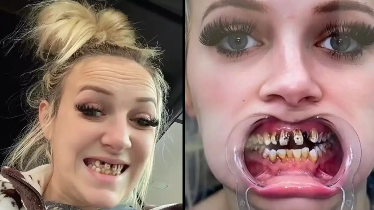 Woman trolled for her wonky teeth gets shock transformation