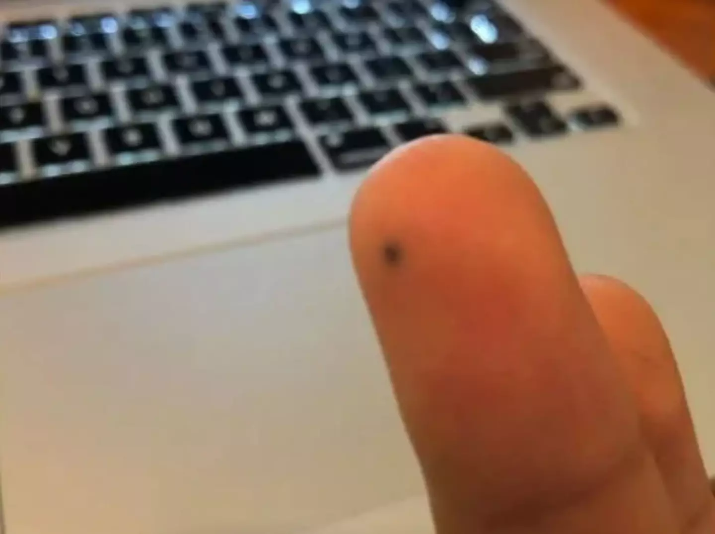 That's gonna leave a mark.