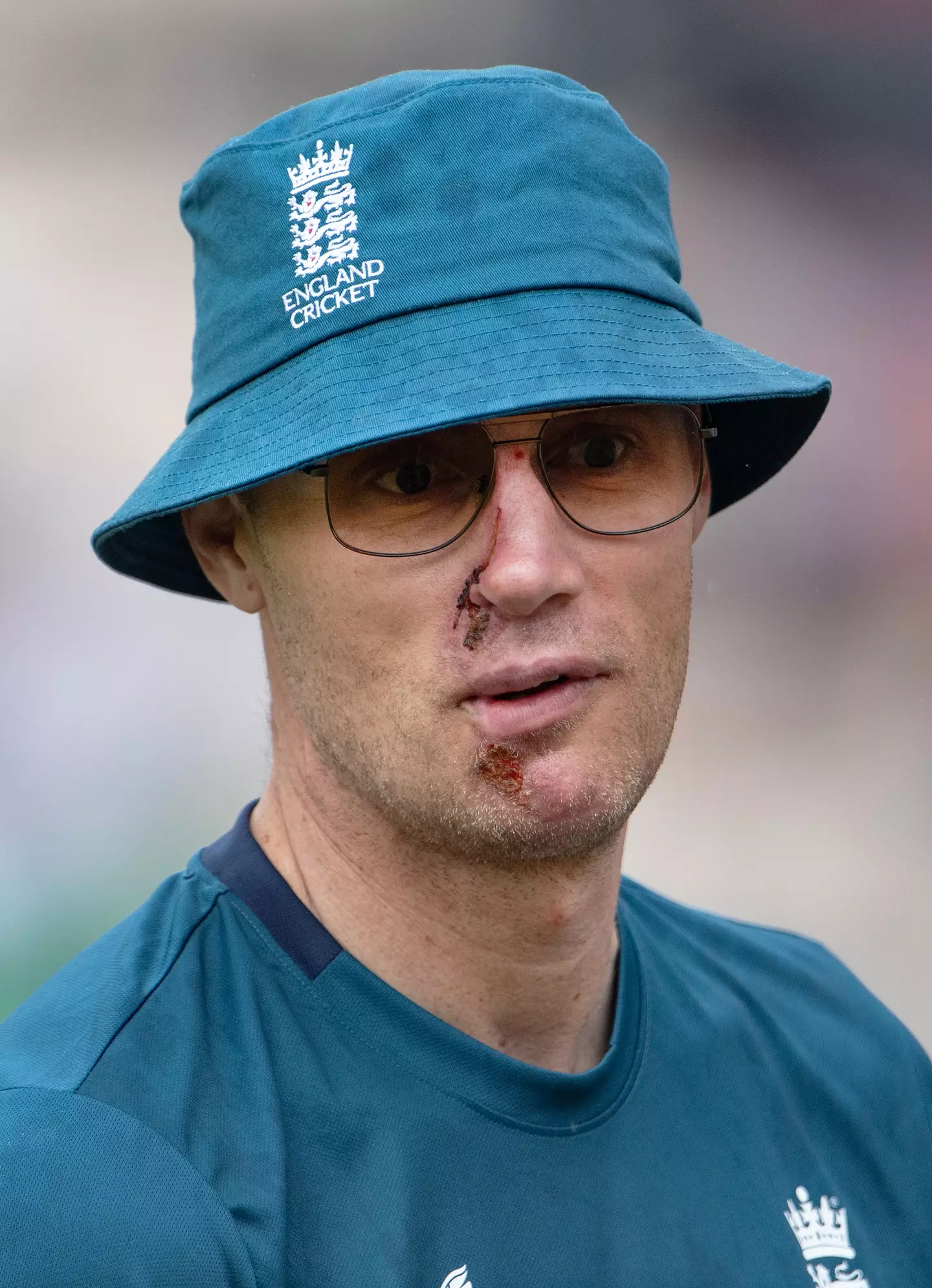 New reports claim Flintoff was going 22mph but did not have a helmet on.