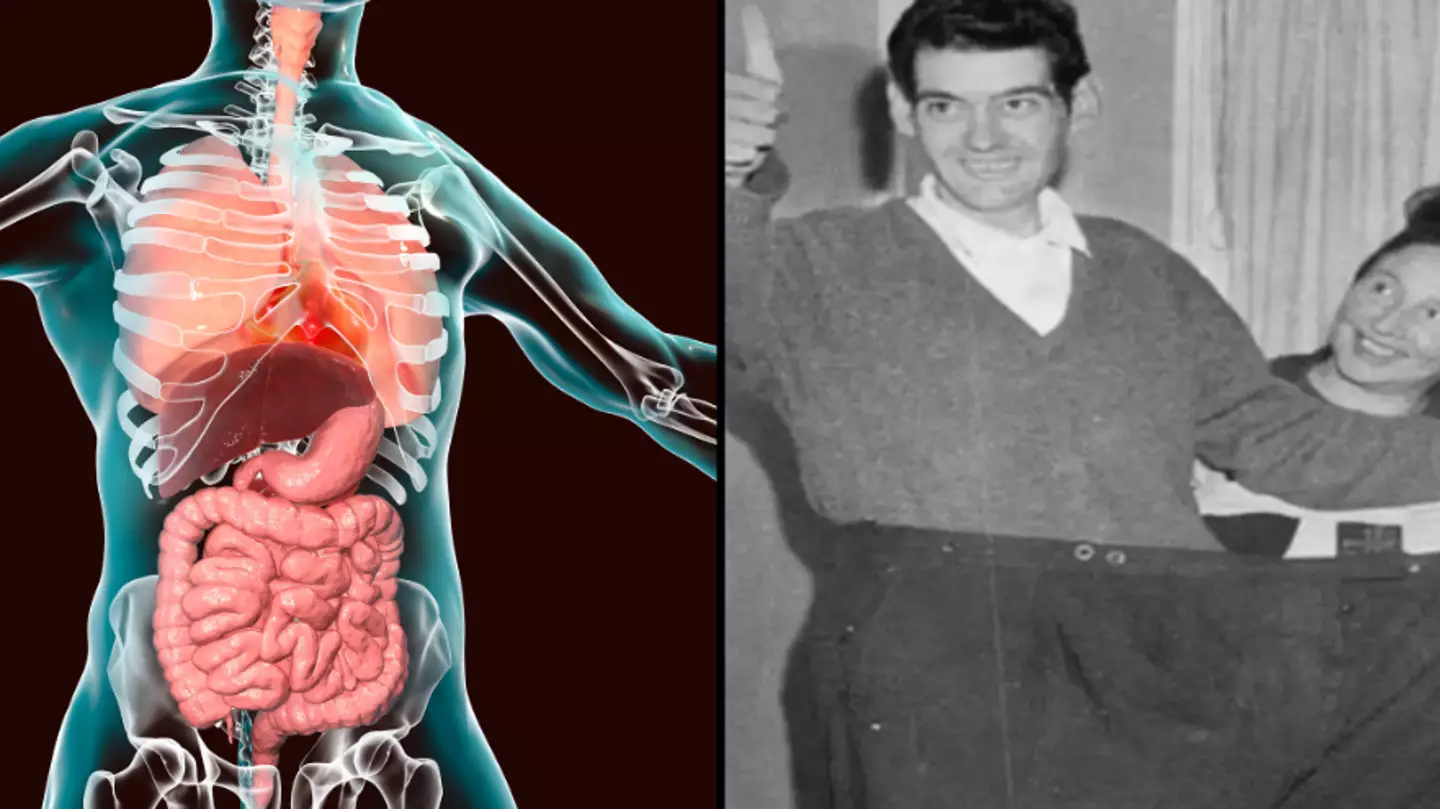 How long it would take to die if you don't eat after man managed to fast for over a year