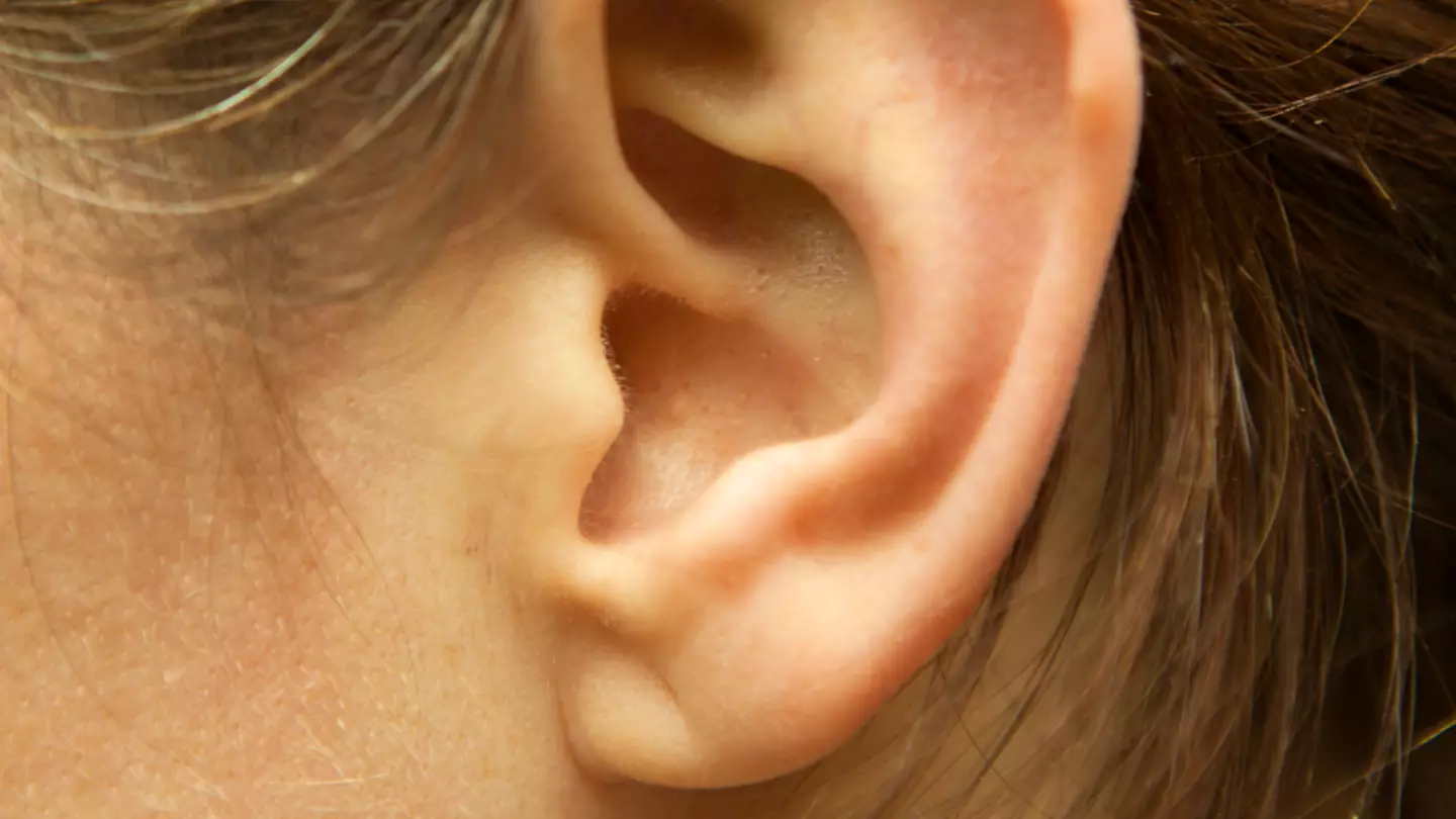 Studies suggest having a crease on your earlobe could predict serious heart condition