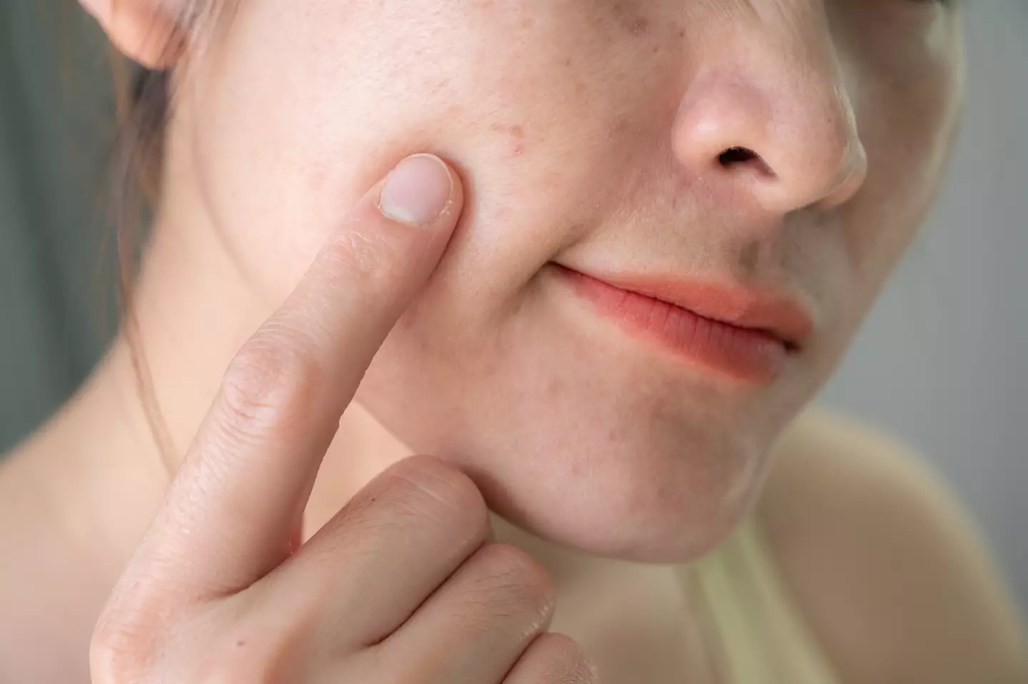 You shouldn't pop spots in the 'triangle of death' (Getty Stock Photo)