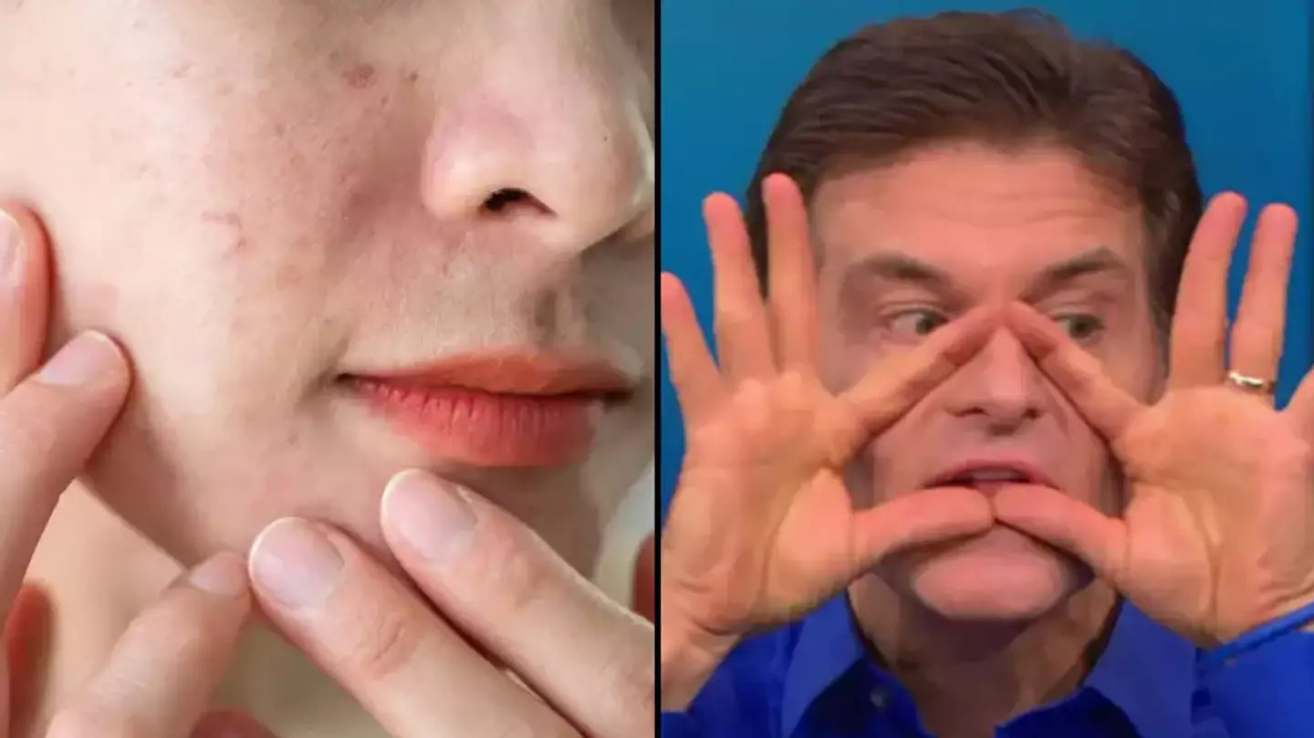Dermatologist explains why you should never attempt to pop a spot in ‘triangle of death’ location