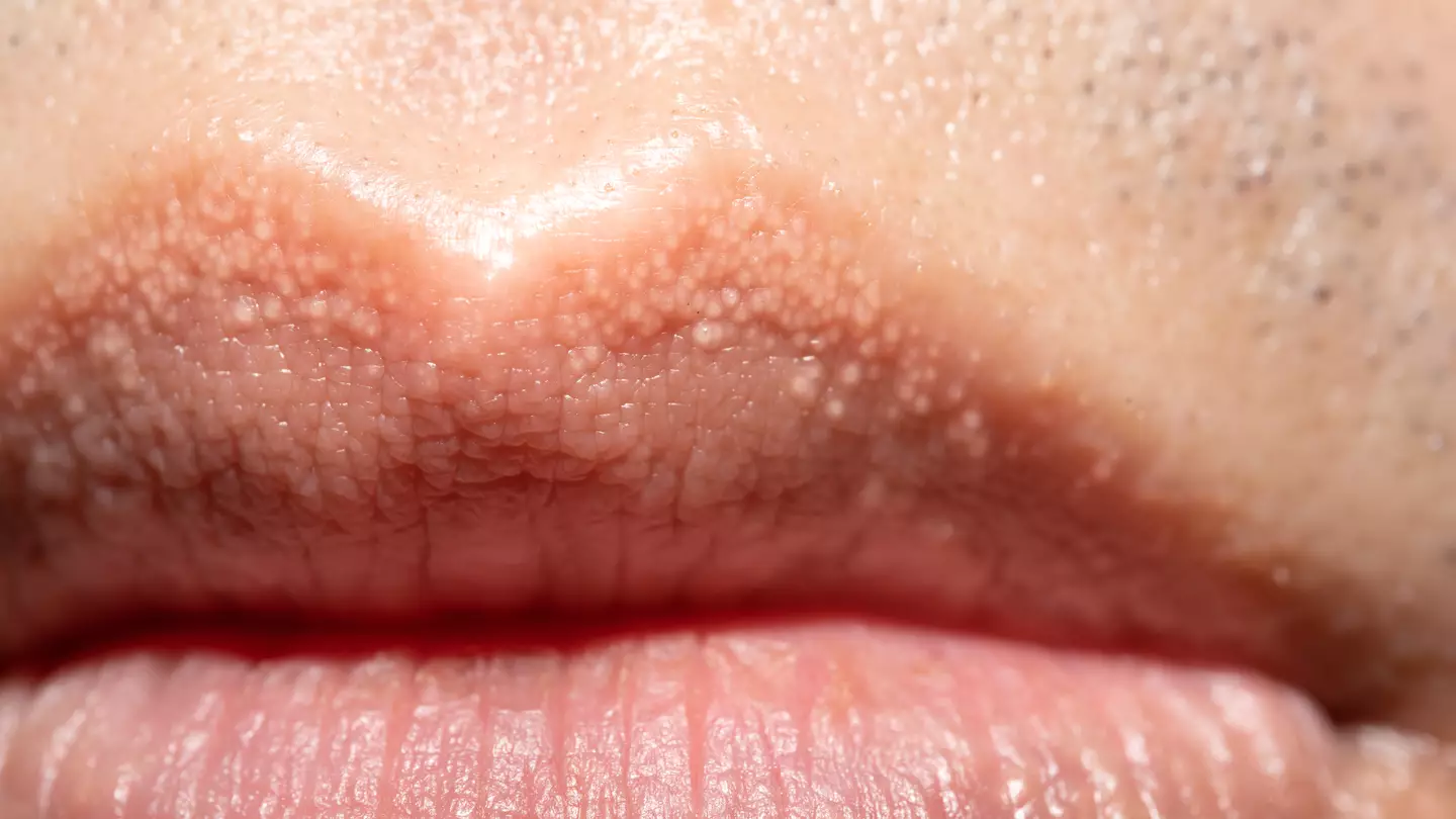 How to know when strange white bumps on body are harmless or could be something more serious