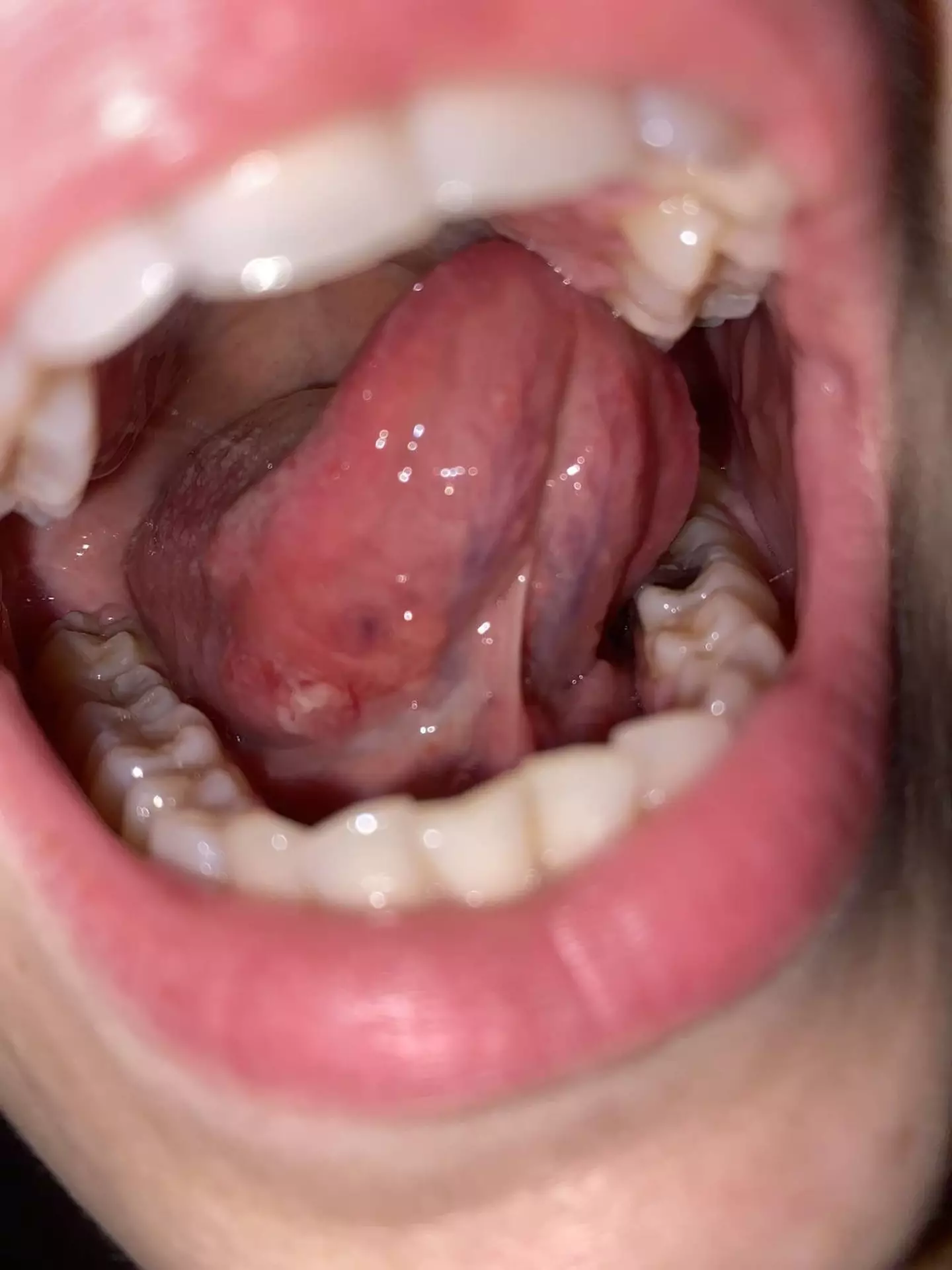 She thought the ulcer was due to her being exhausted at work (Kennedy News and Media)