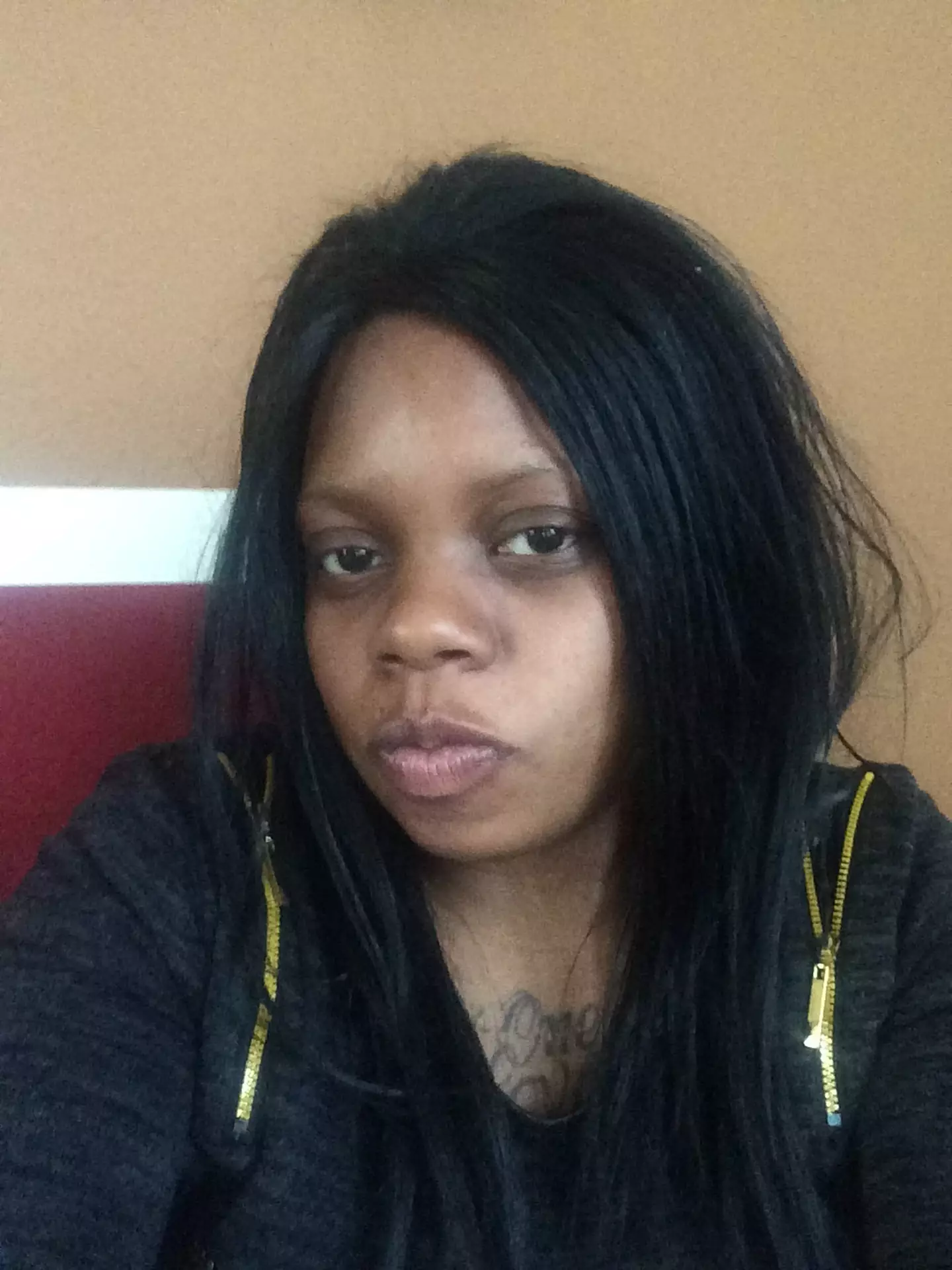 Anaya says she now regrets the procedure.